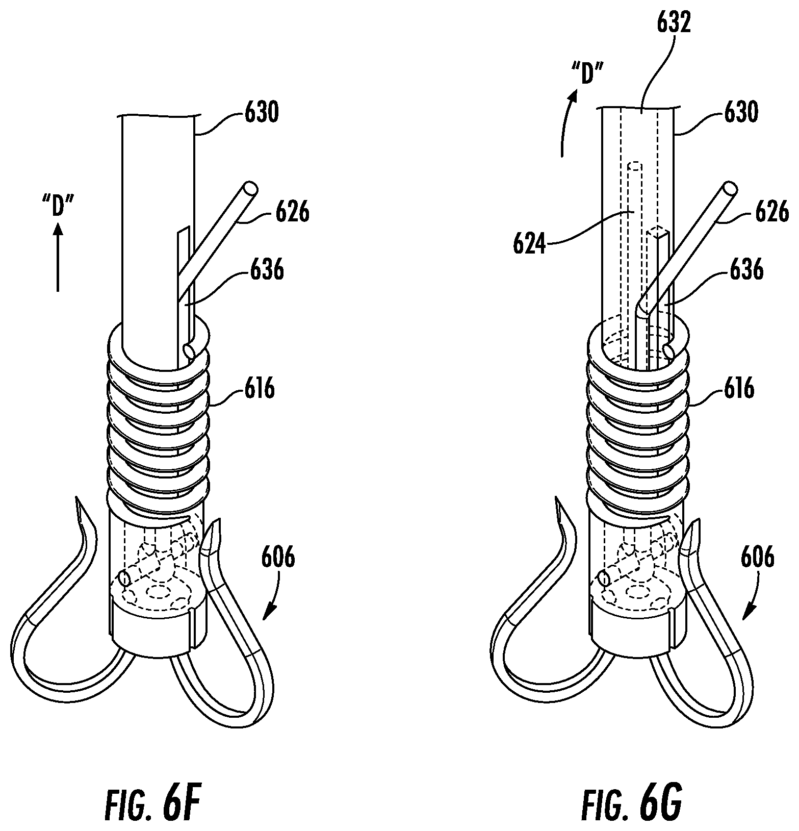 Patent US12551342 Figure 8 – Devices, systems, and methods for adjustably tensioning an artificial chordae tendineae between a leaflet and a papillary muscle or heart wall