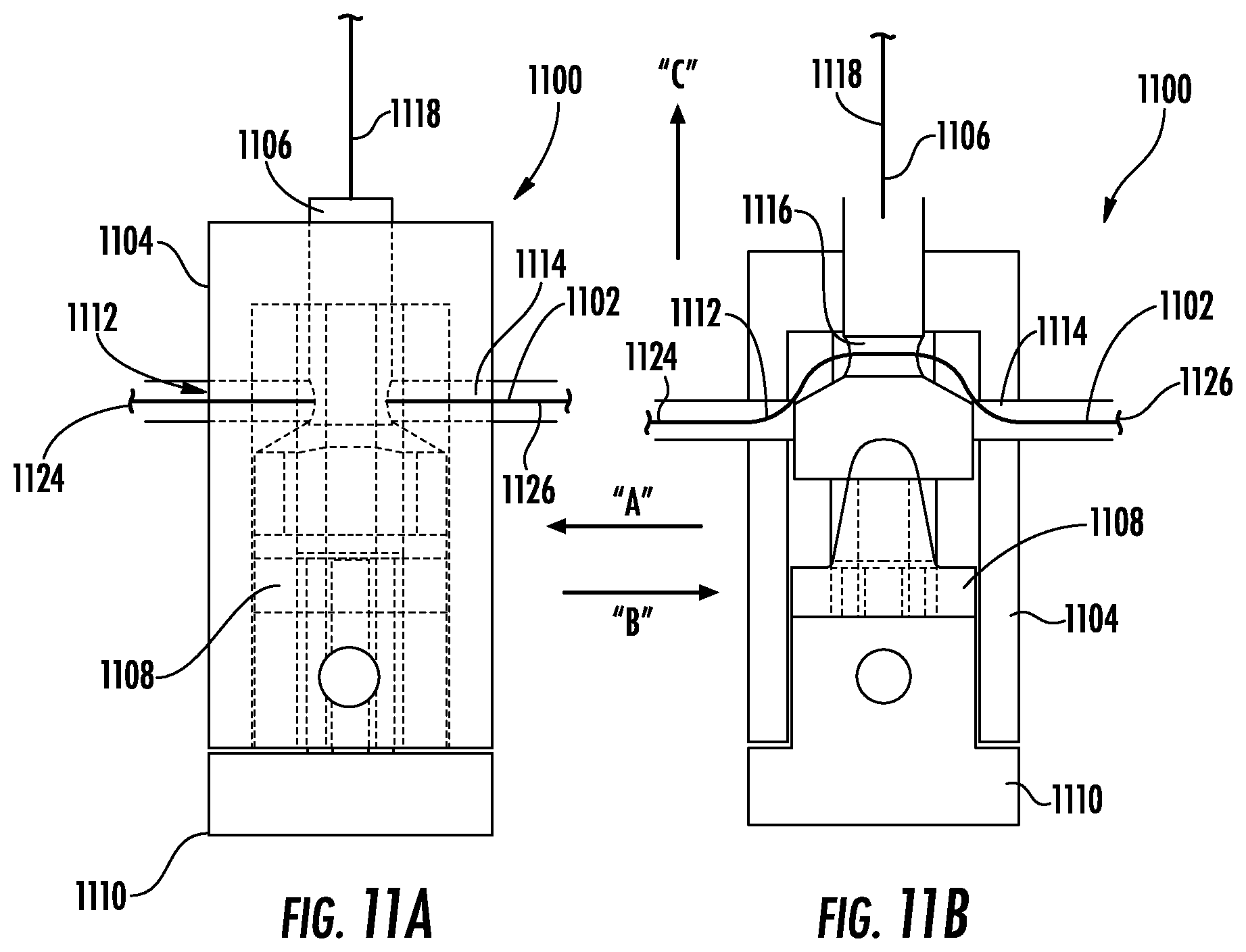 Patent US12551342 Figure 15 – Devices, systems, and methods for adjustably tensioning an artificial chordae tendineae between a leaflet and a papillary muscle or heart wall