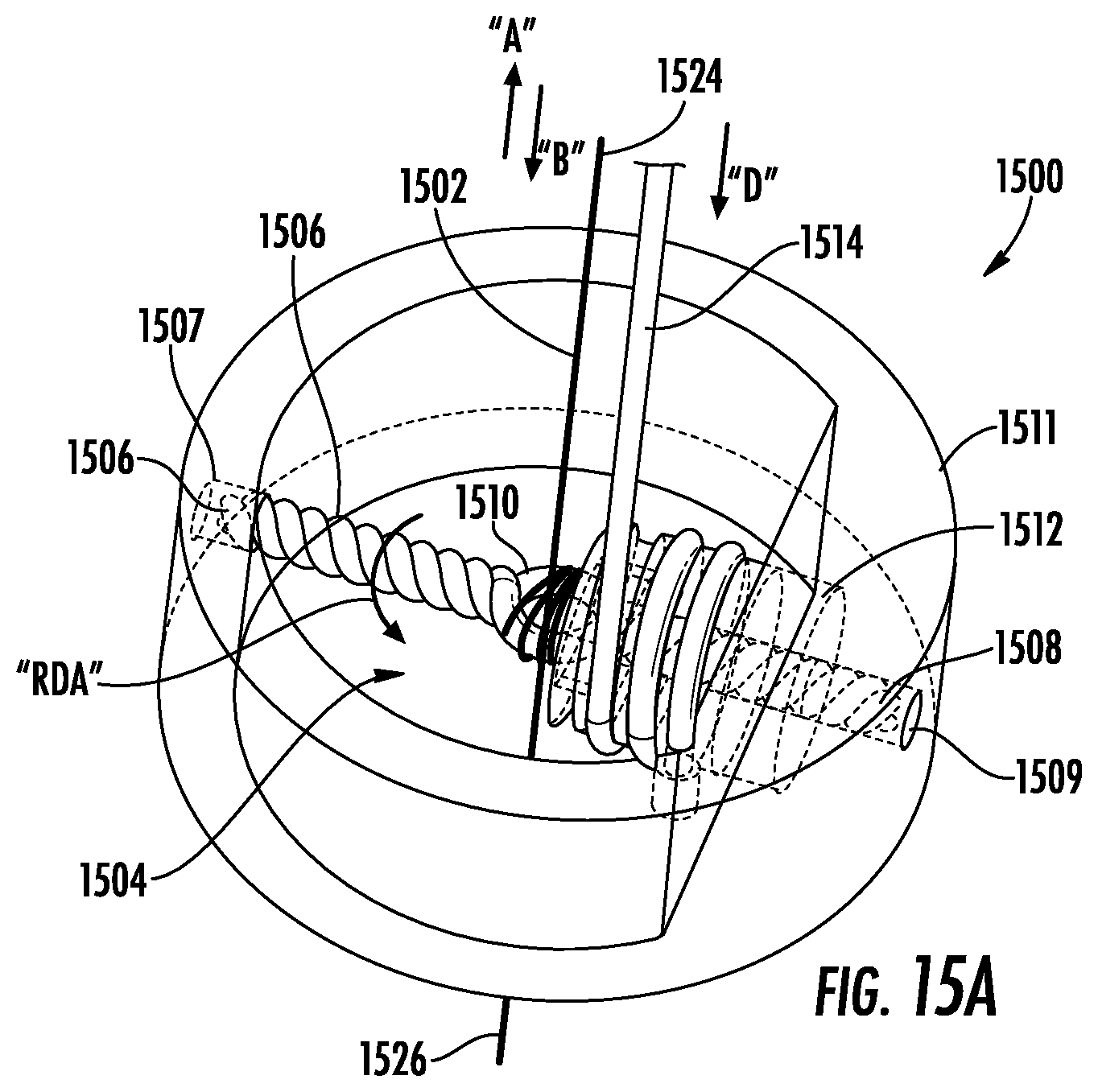Patent US12551342 Figure 20 – Devices, systems, and methods for adjustably tensioning an artificial chordae tendineae between a leaflet and a papillary muscle or heart wall