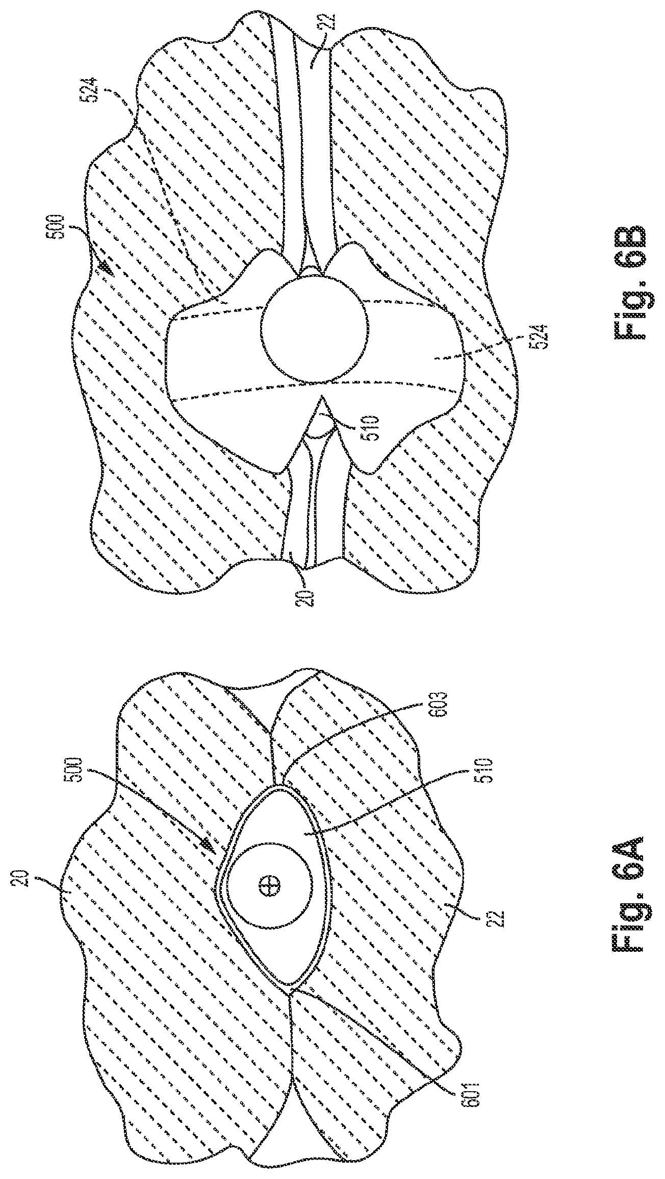 Patent US12551344 Figure 8 – Heart valve sealing devices and delivery devices therefor
