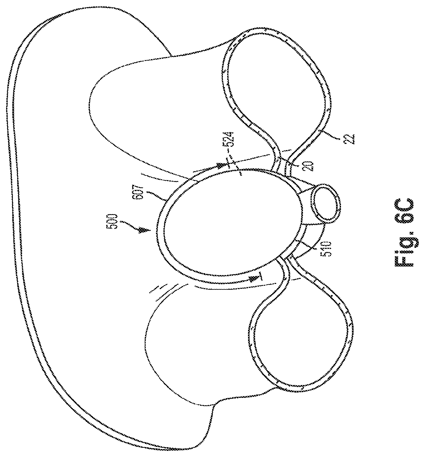 Patent US12551344 Figure 9 – Heart valve sealing devices and delivery devices therefor