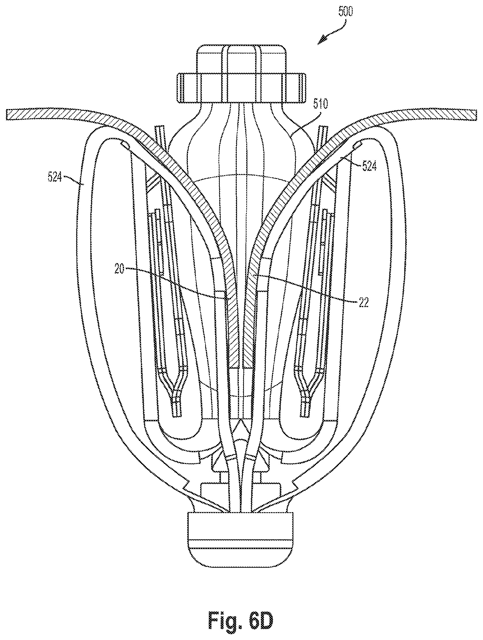 Patent US12551344 Figure 10 – Heart valve sealing devices and delivery devices therefor