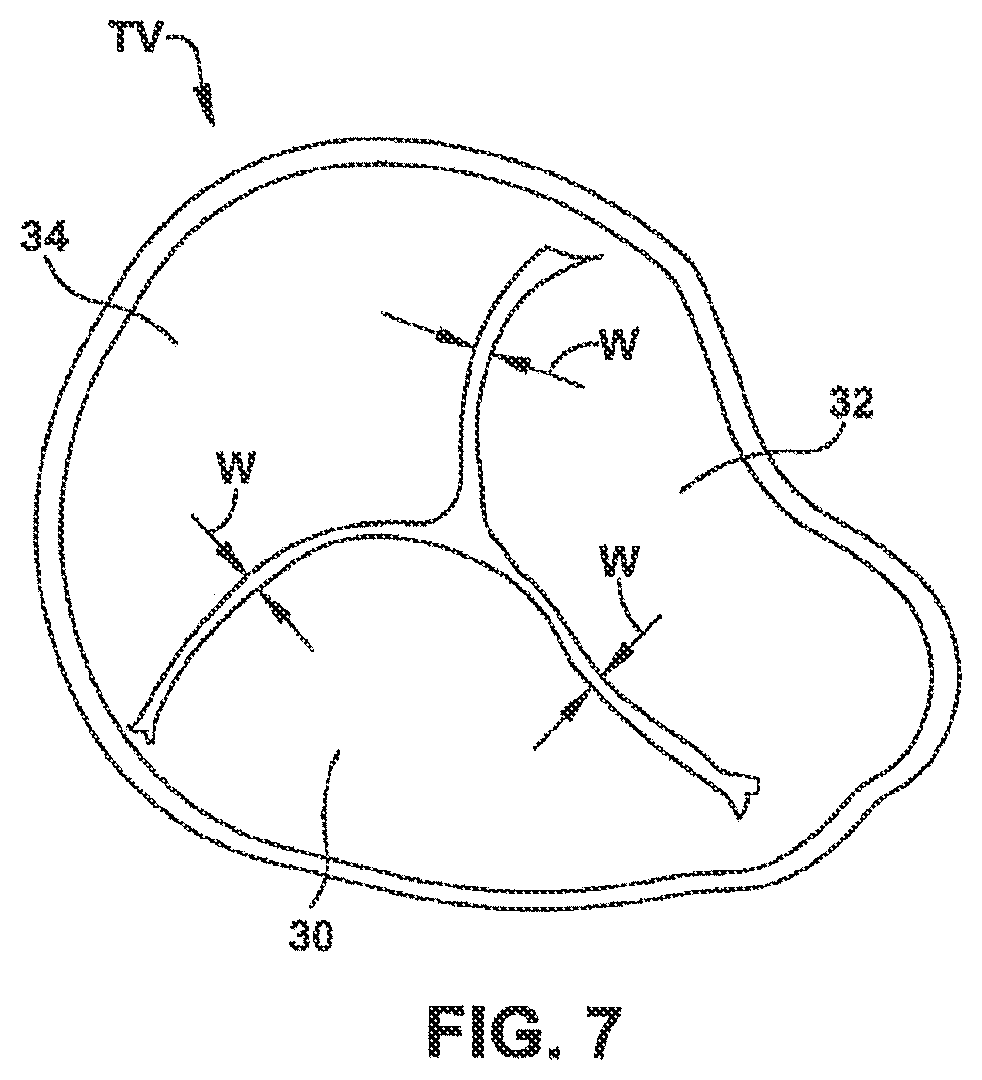 Patent US12551344 Figure 12 – Heart valve sealing devices and delivery devices therefor