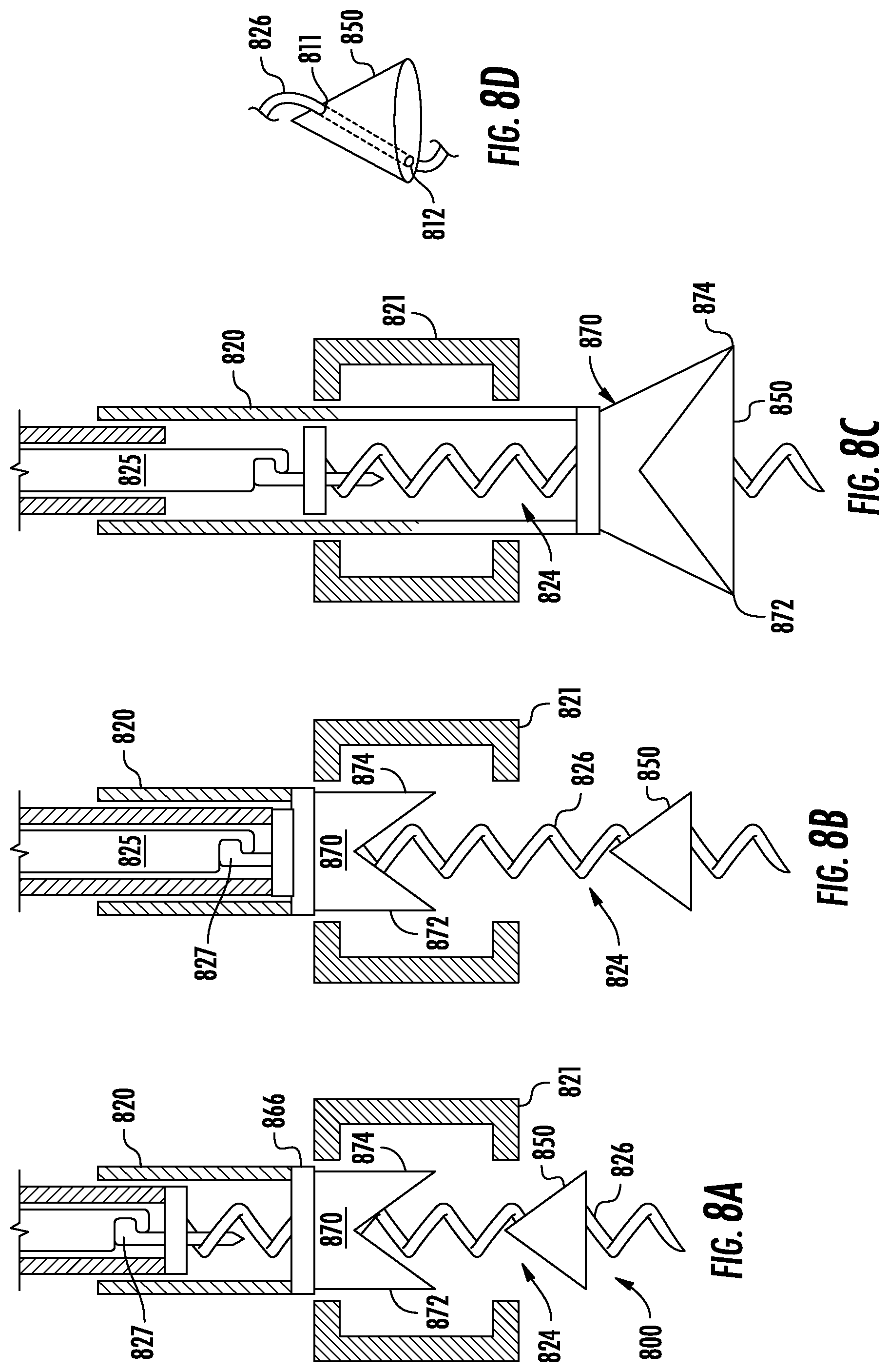 Patent US12551345 Figure 12 – Coil and barb anchors for heart valve repair devices