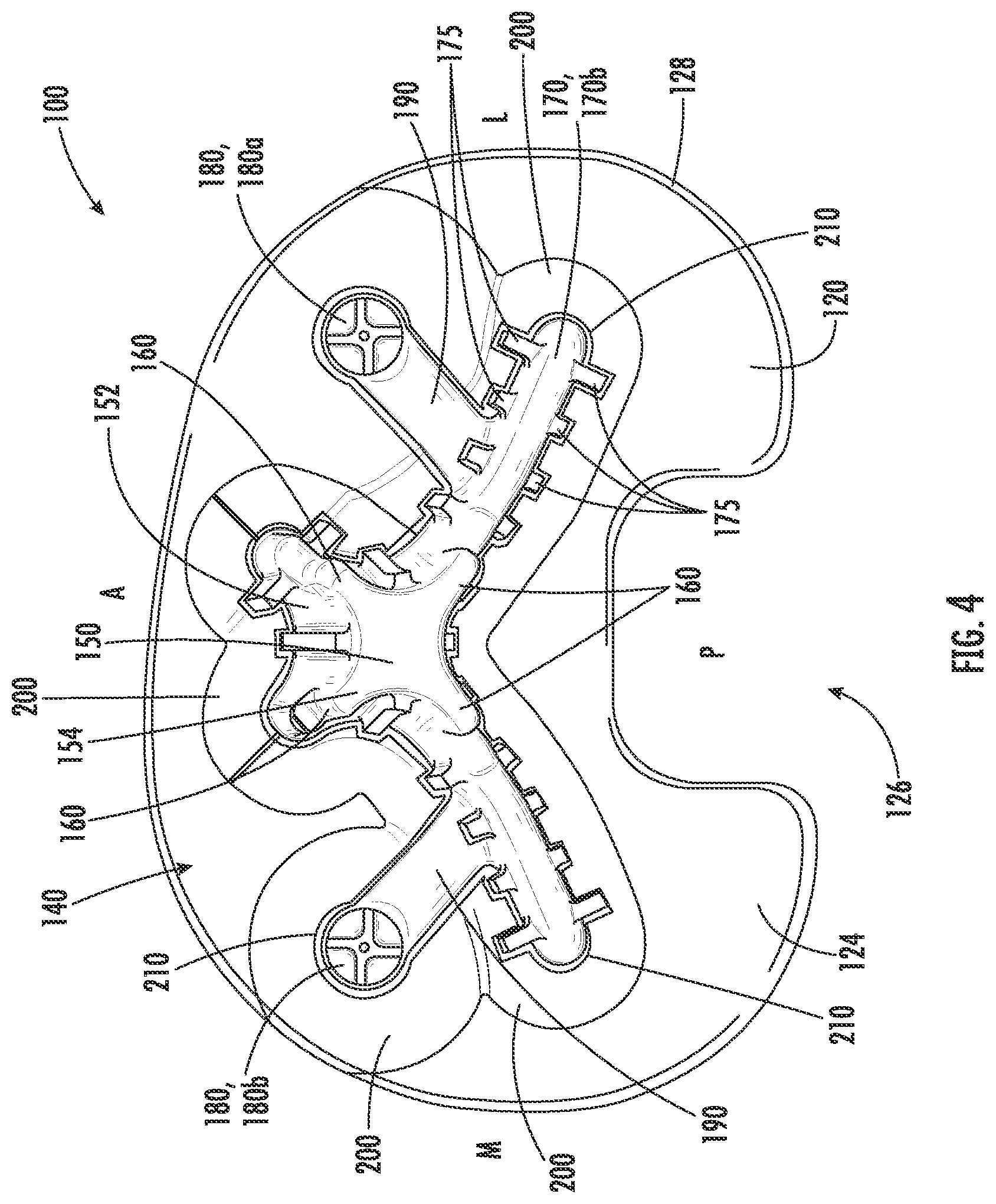 Patent US12551346 Figure 4 – Tibial implant with improved anterior load transfer