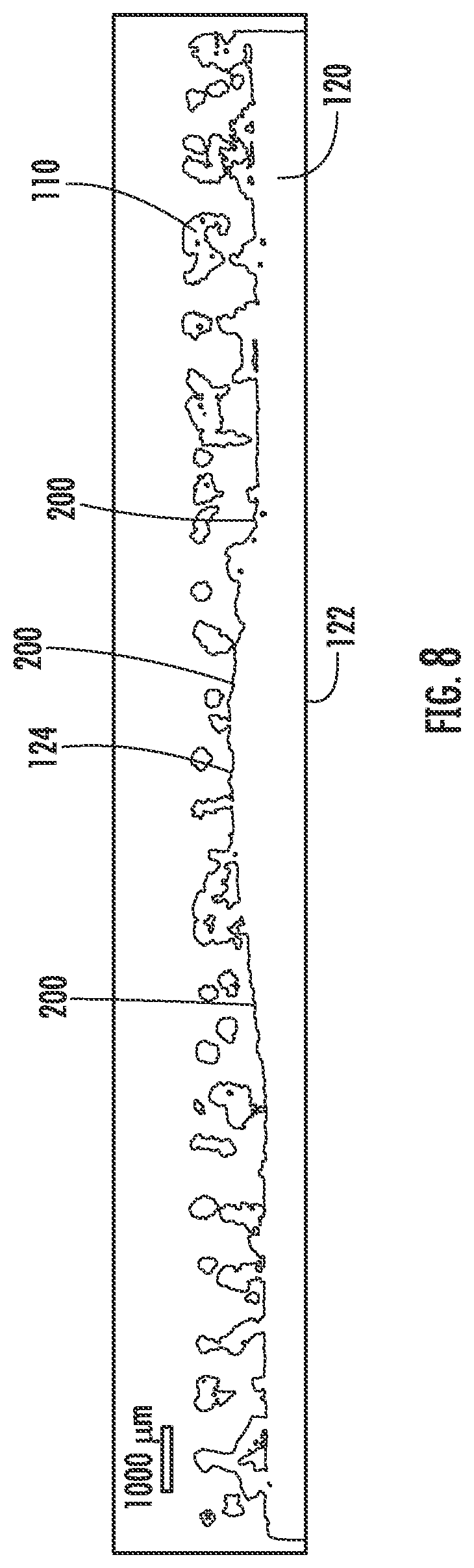 Patent US12551346 Figure 8 – Tibial implant with improved anterior load transfer