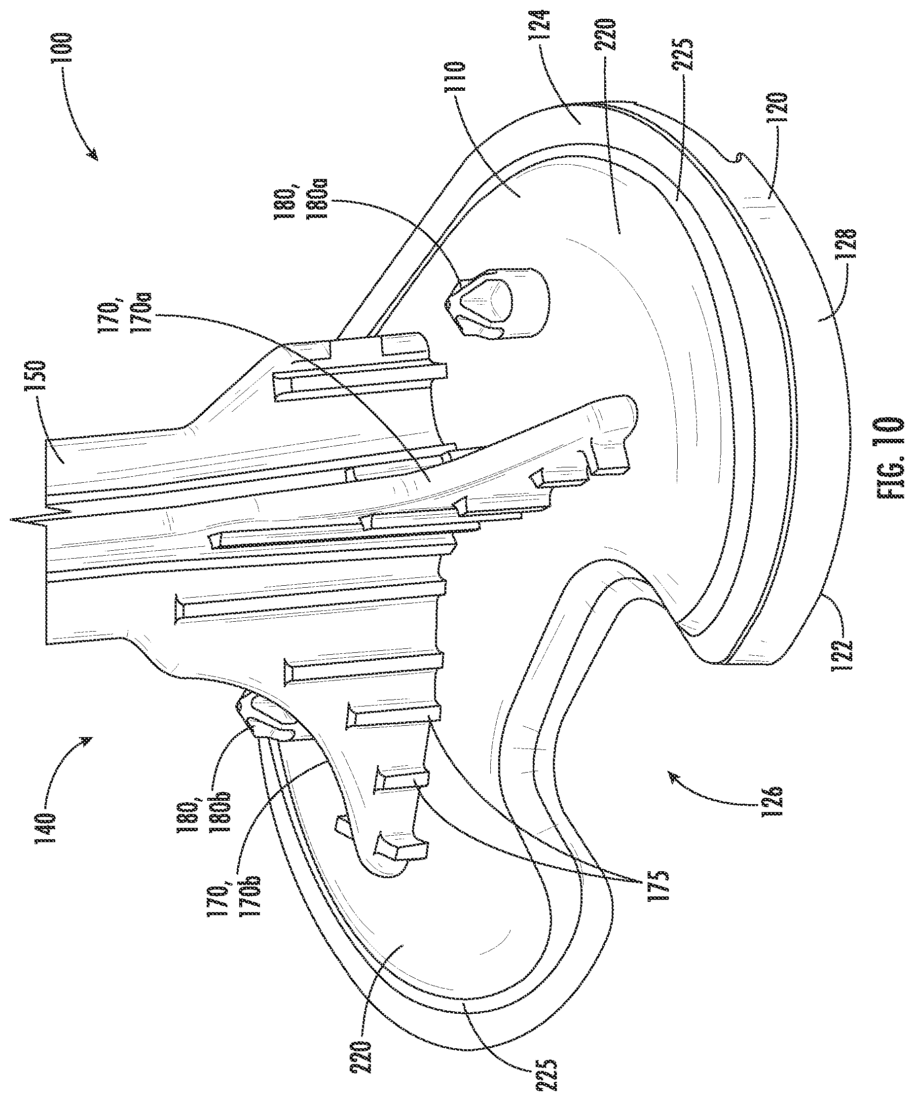 Patent US12551346 Figure 10 – Tibial implant with improved anterior load transfer