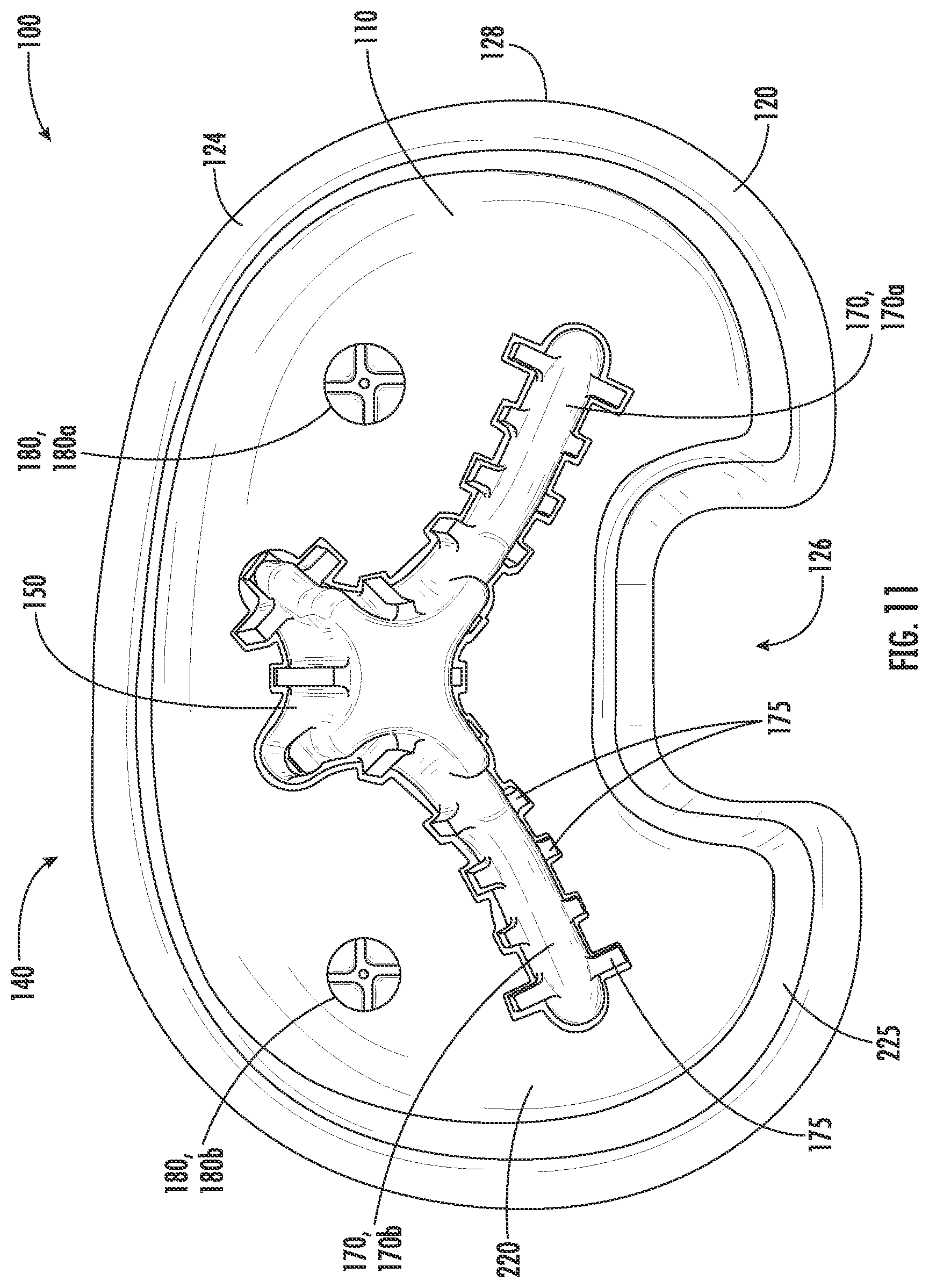 Patent US12551346 Figure 11 – Tibial implant with improved anterior load transfer