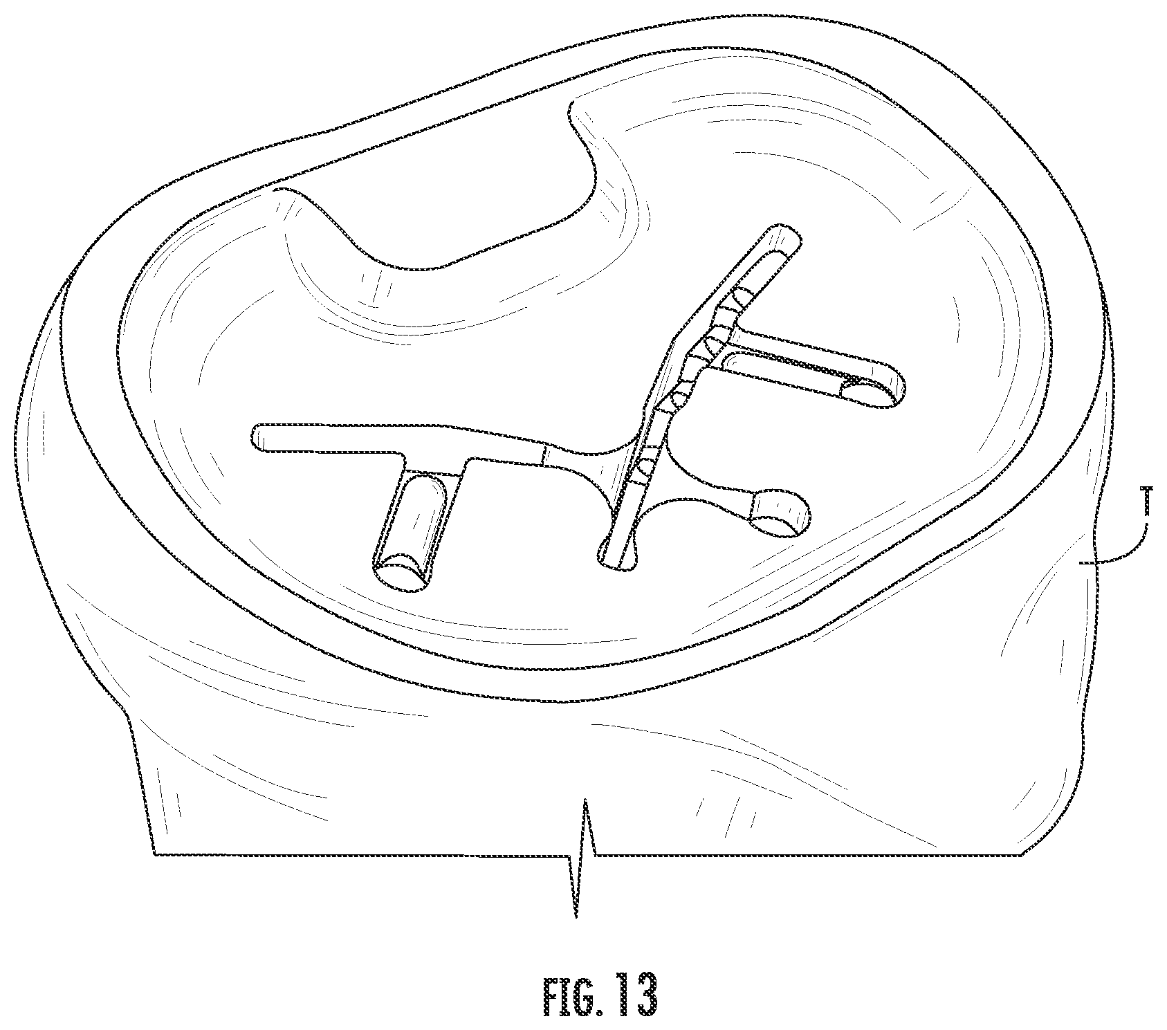 Patent US12551346 Figure 13 – Tibial implant with improved anterior load transfer