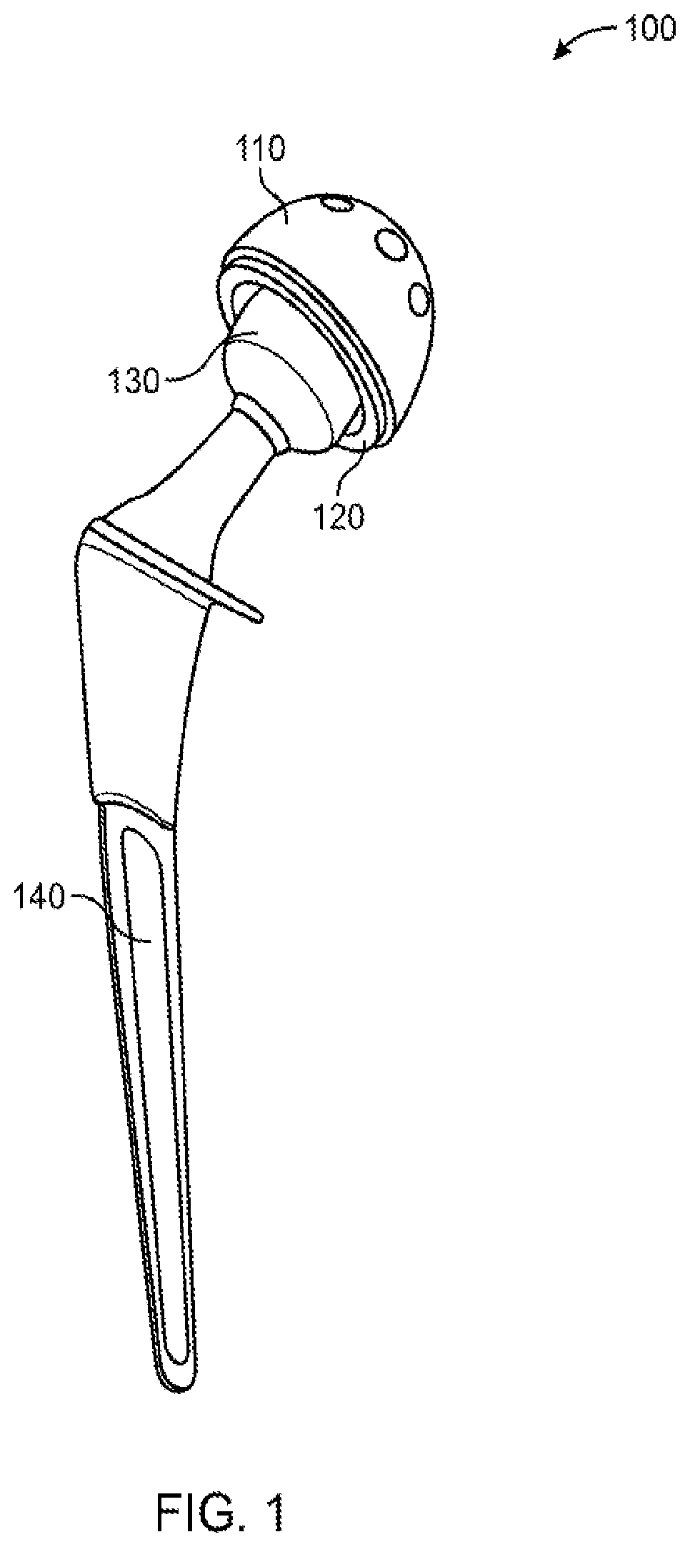 Patent US12551347 Figure 1 – Apparatus and method for forming a custom cement-on-cement articulating hip spacer