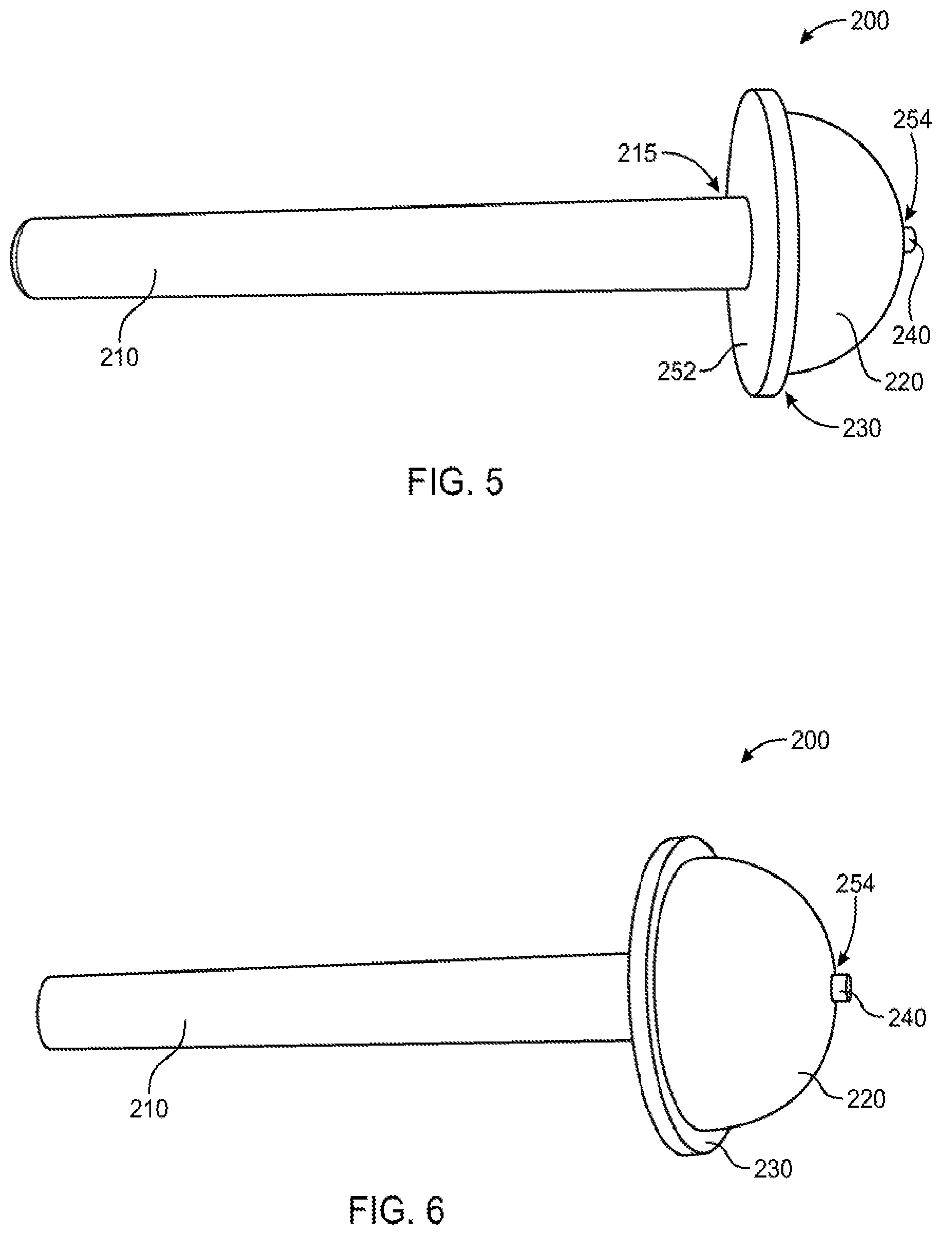 Patent US12551347 Figure 5 – Apparatus and method for forming a custom cement-on-cement articulating hip spacer