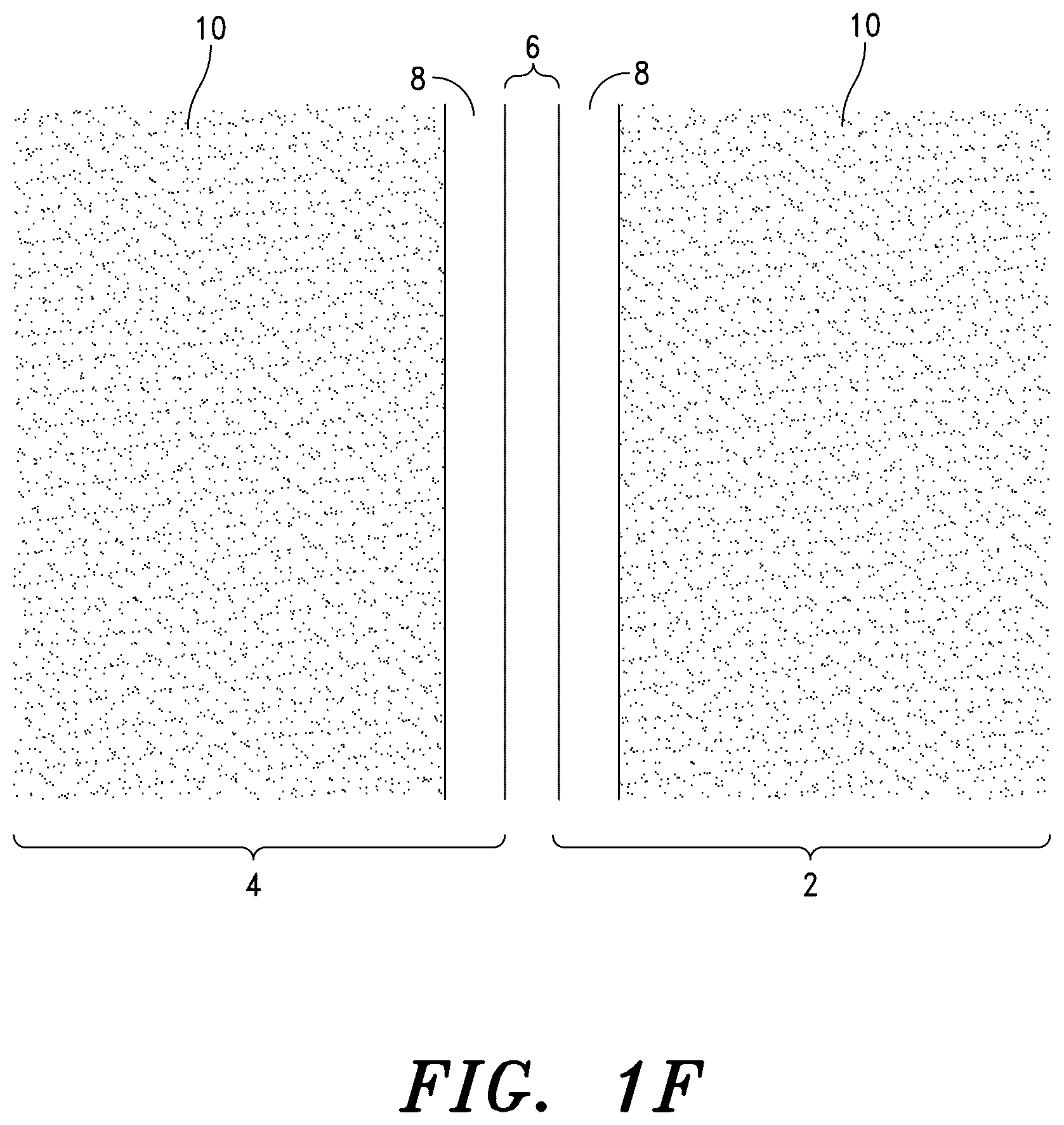 Patent US12551348 Figure 5 – Systems for sacroiliac joint stabilization