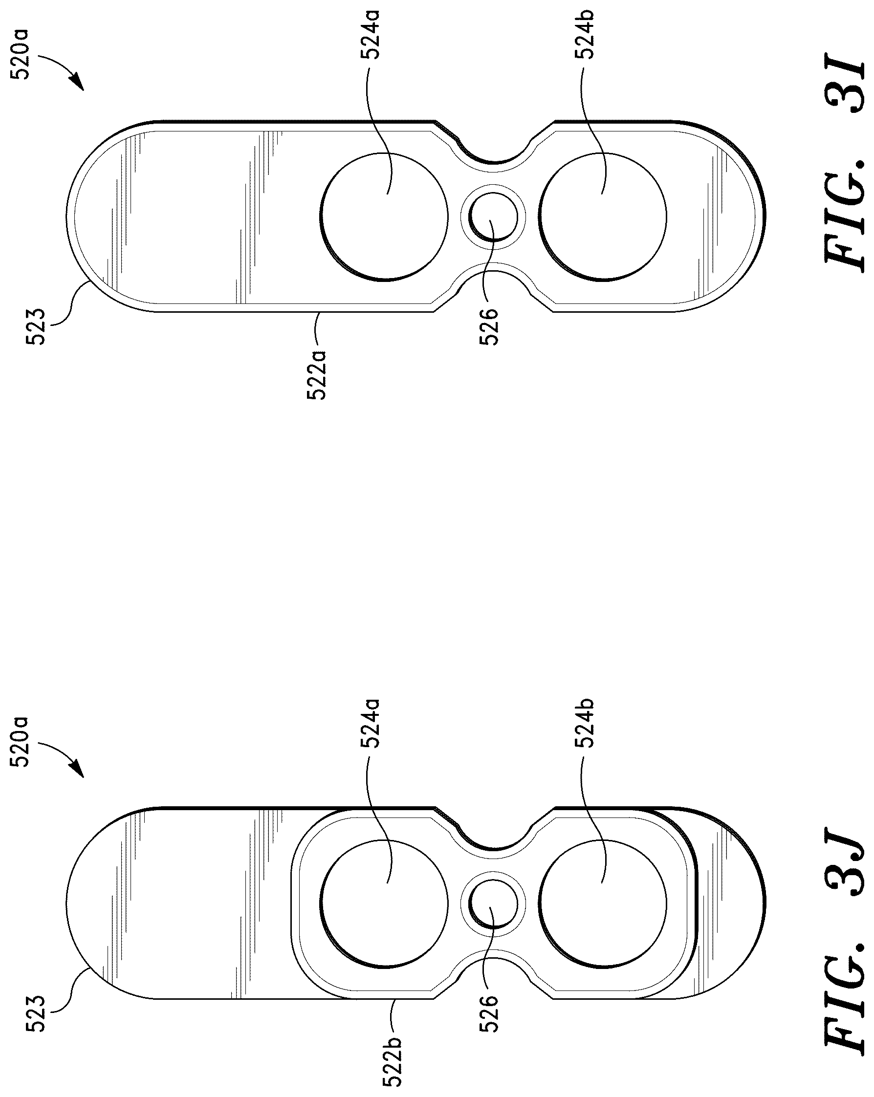 Patent US12551348 Figure 12 – Systems for sacroiliac joint stabilization
