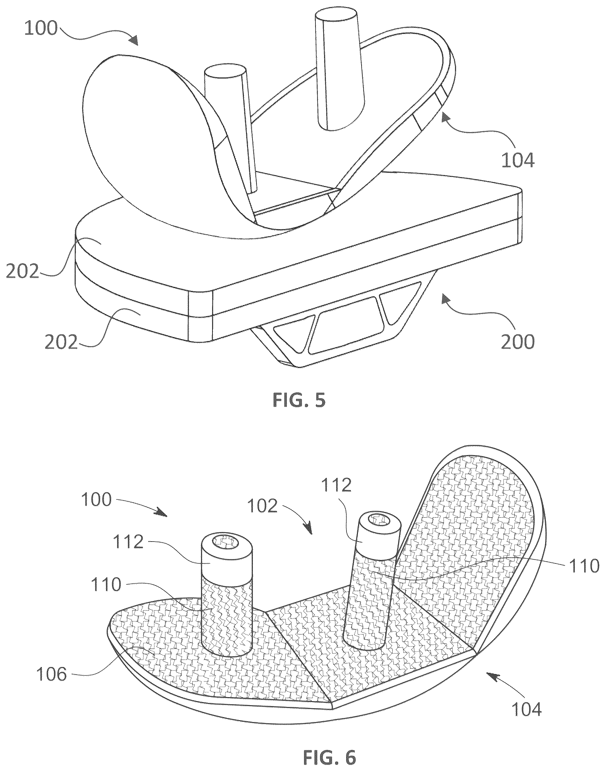 Patent US12551349 Figure 3 – Implant component