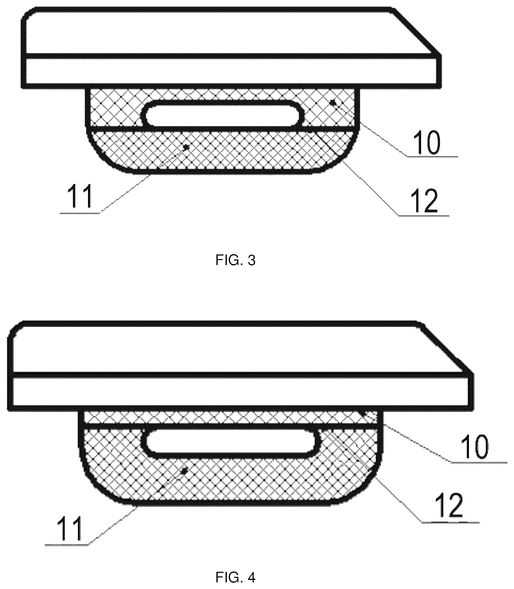 Patent US12551350 Figure 2 – Zonal trabecular uni-compartmental tibial plateau containing zirconium-niobium alloy on oxidation layer and preparation method thereof