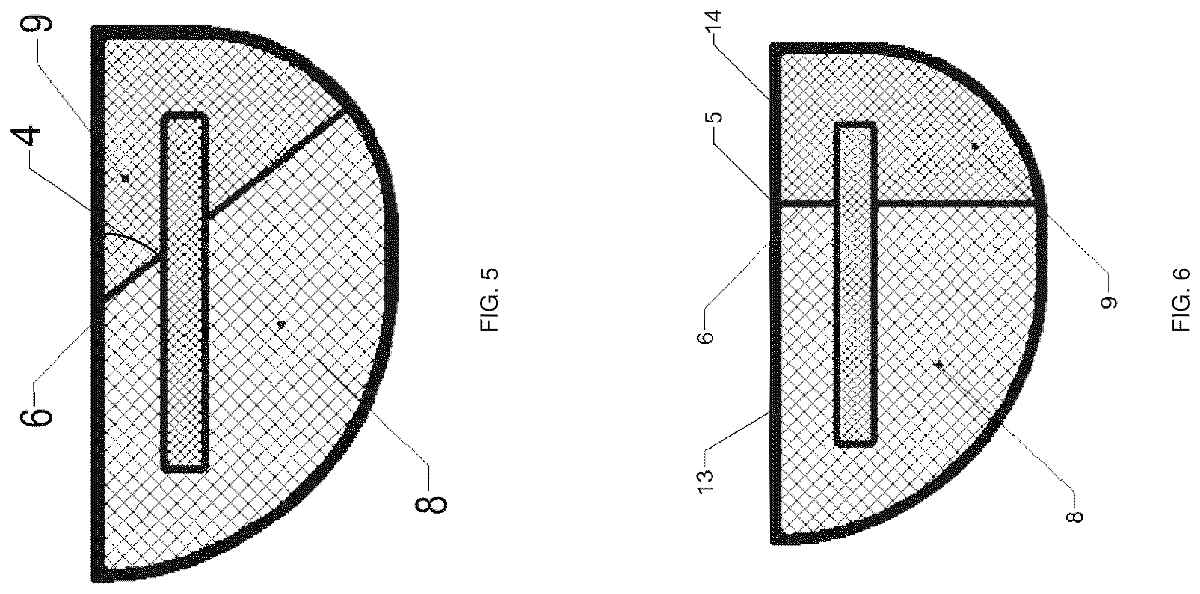 Patent US12551350 Figure 3 – Zonal trabecular uni-compartmental tibial plateau containing zirconium-niobium alloy on oxidation layer and preparation method thereof