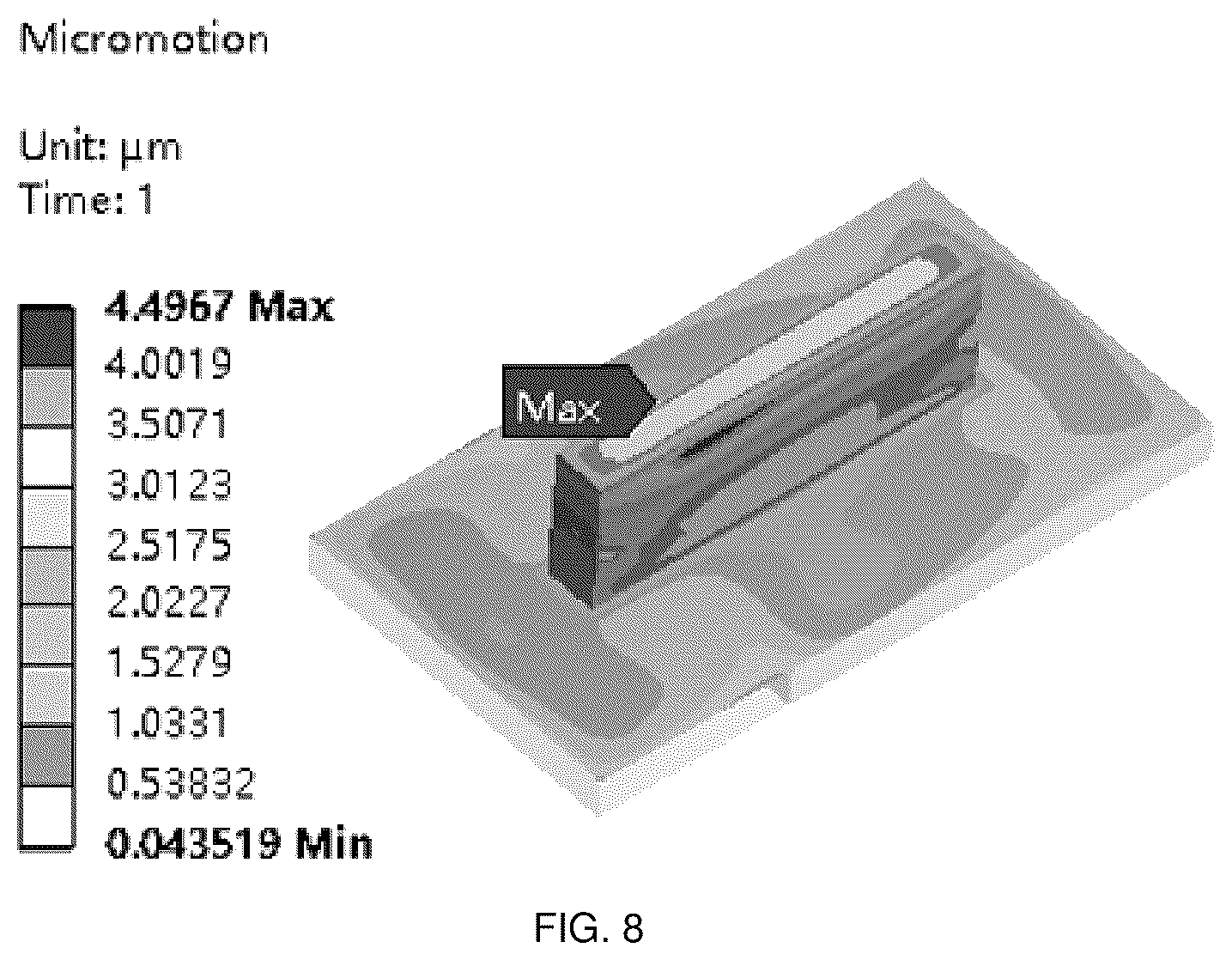 Patent US12551350 Figure 5 – Zonal trabecular uni-compartmental tibial plateau containing zirconium-niobium alloy on oxidation layer and preparation method thereof