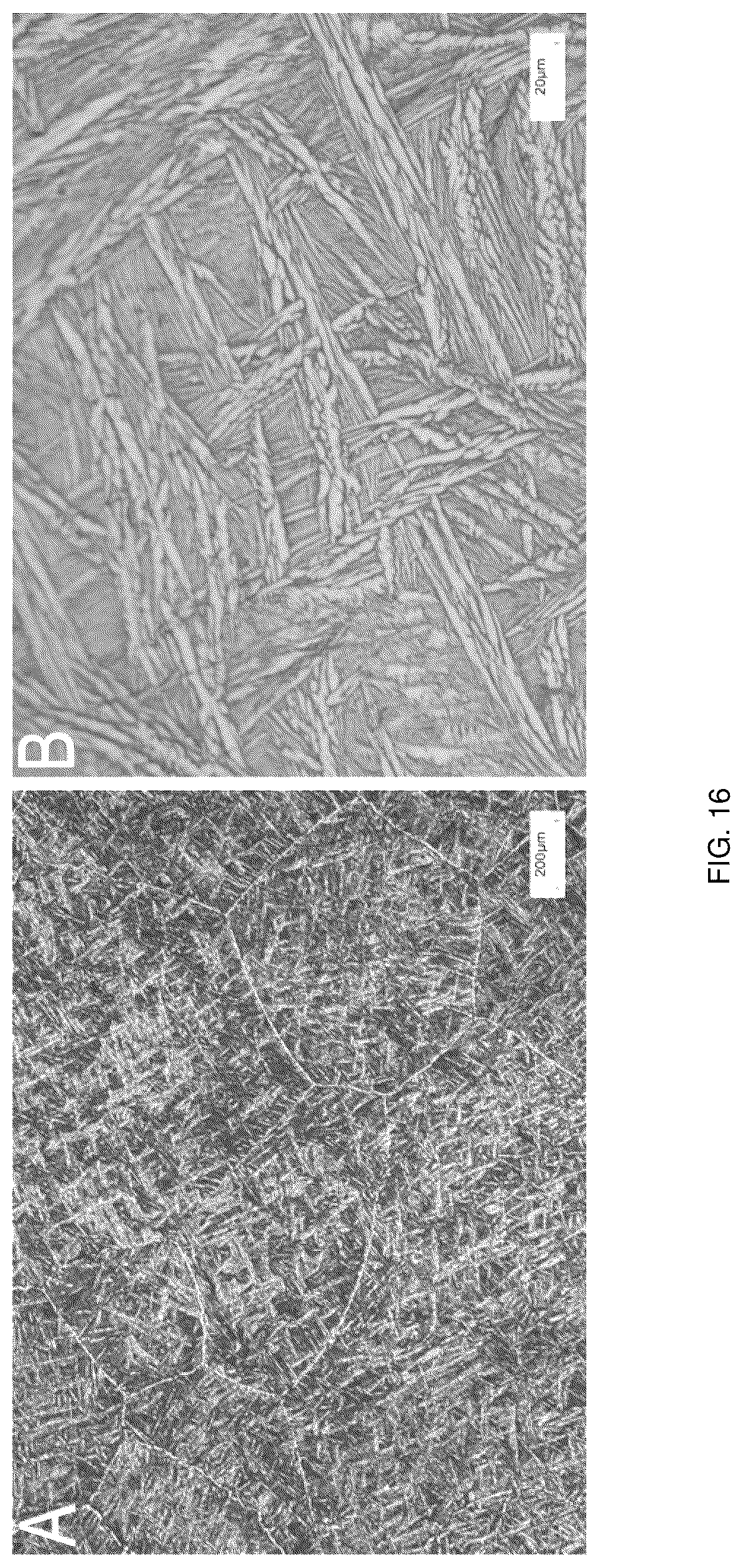 Patent US12551350 Figure 13 – Zonal trabecular uni-compartmental tibial plateau containing zirconium-niobium alloy on oxidation layer and preparation method thereof