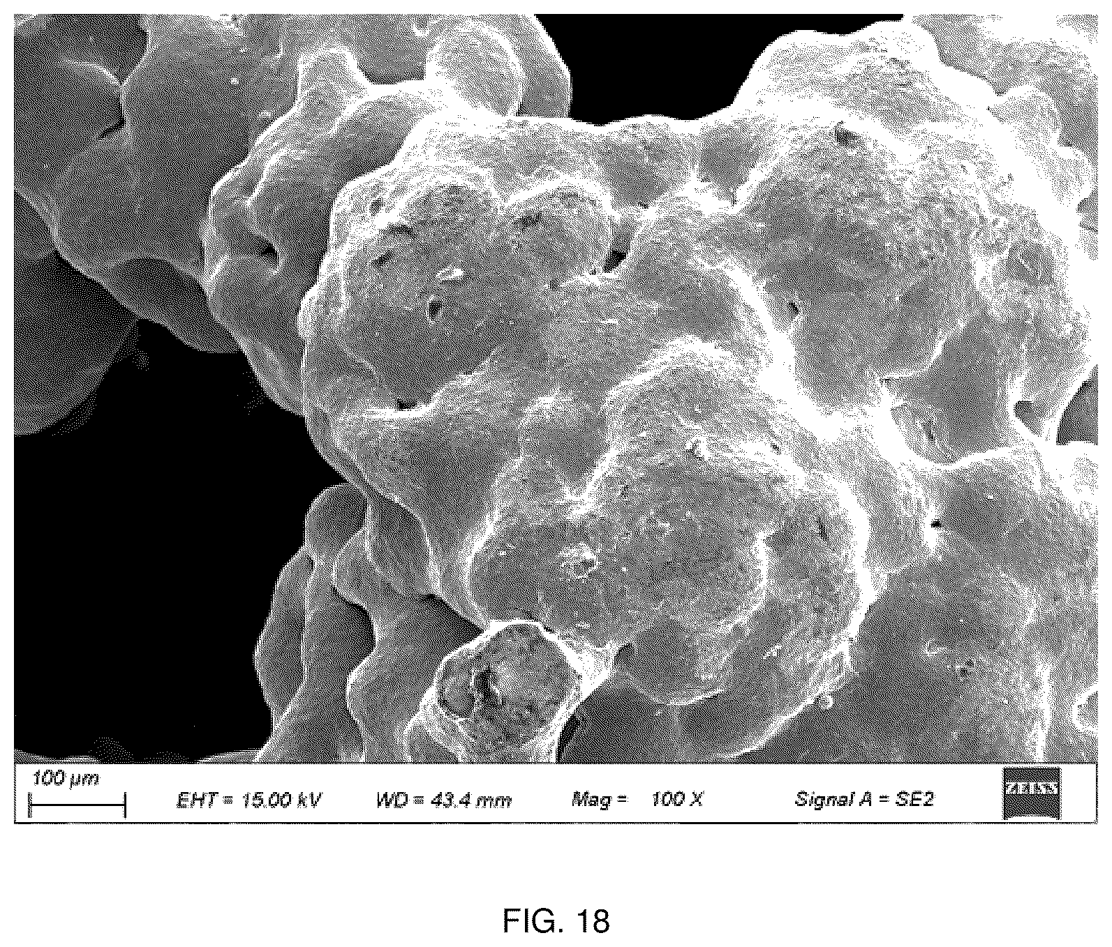 Patent US12551350 Figure 15 – Zonal trabecular uni-compartmental tibial plateau containing zirconium-niobium alloy on oxidation layer and preparation method thereof