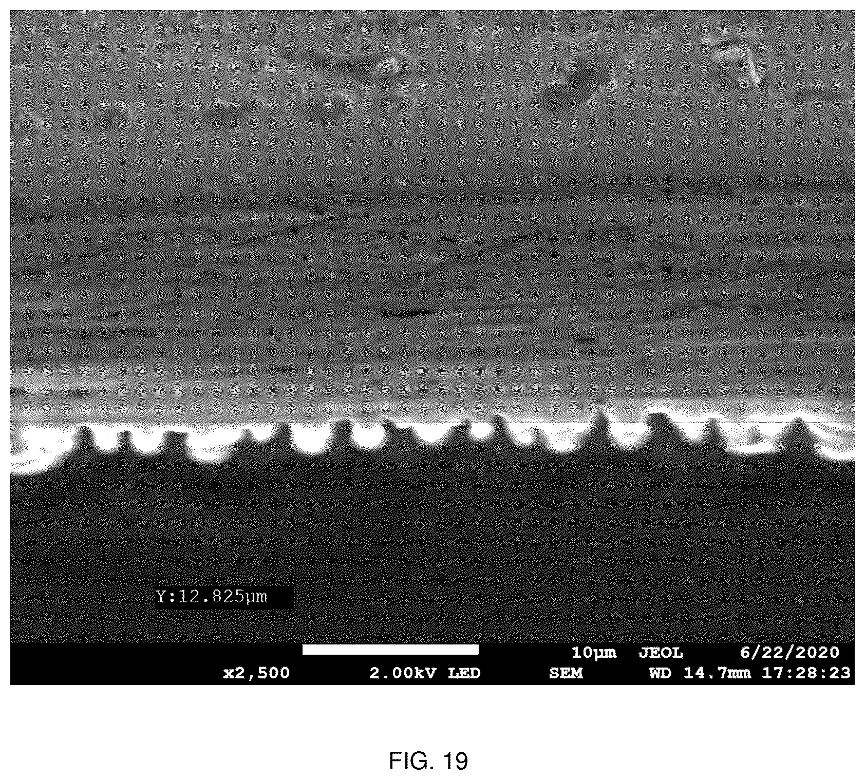 Patent US12551350 Figure 16 – Zonal trabecular uni-compartmental tibial plateau containing zirconium-niobium alloy on oxidation layer and preparation method thereof