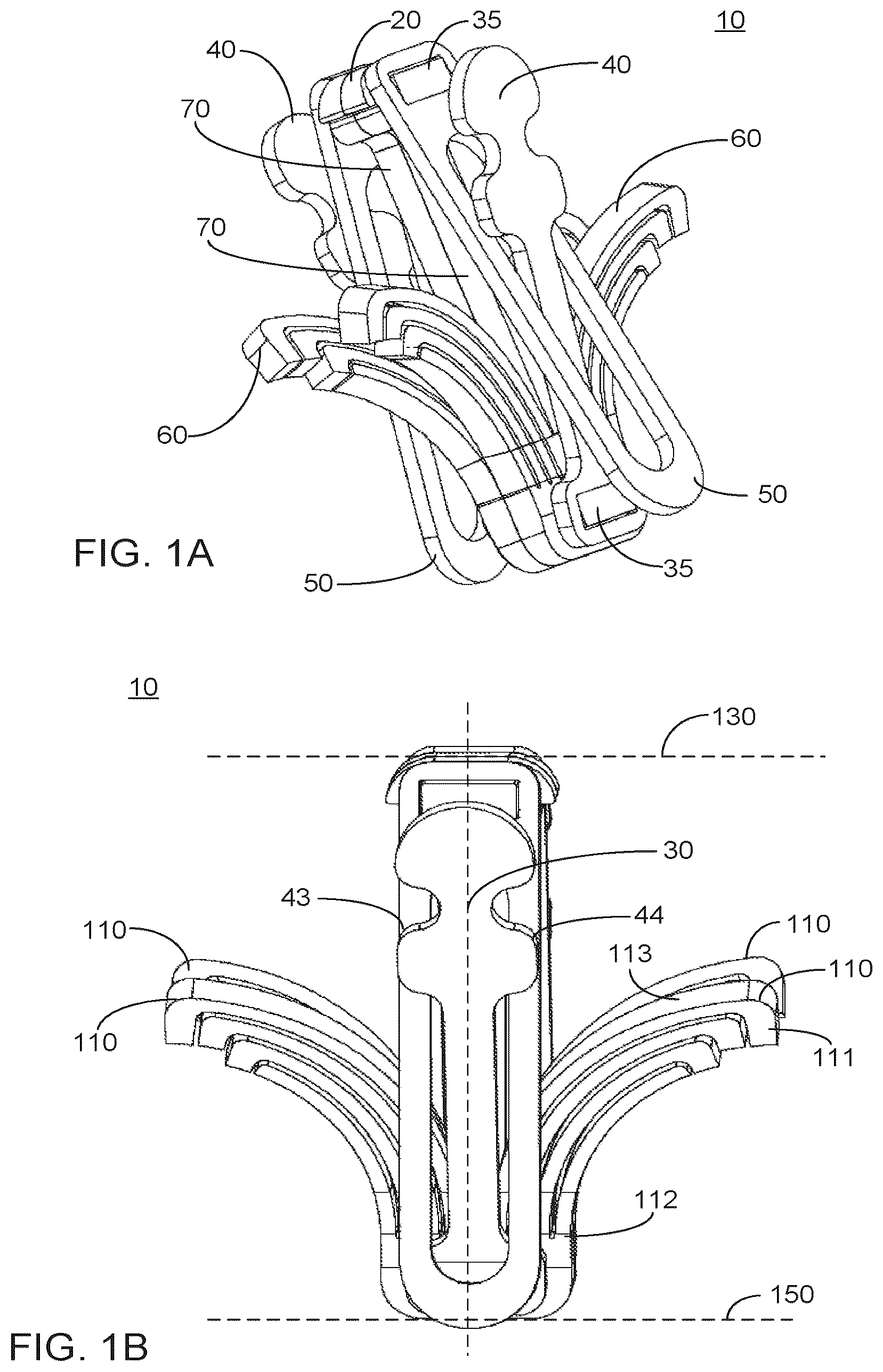 Patent US12551351 Figure 1 – Implant