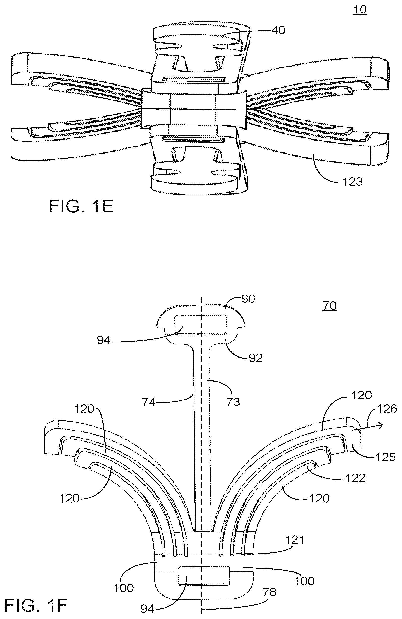 Patent US12551351 Figure 3 – Implant