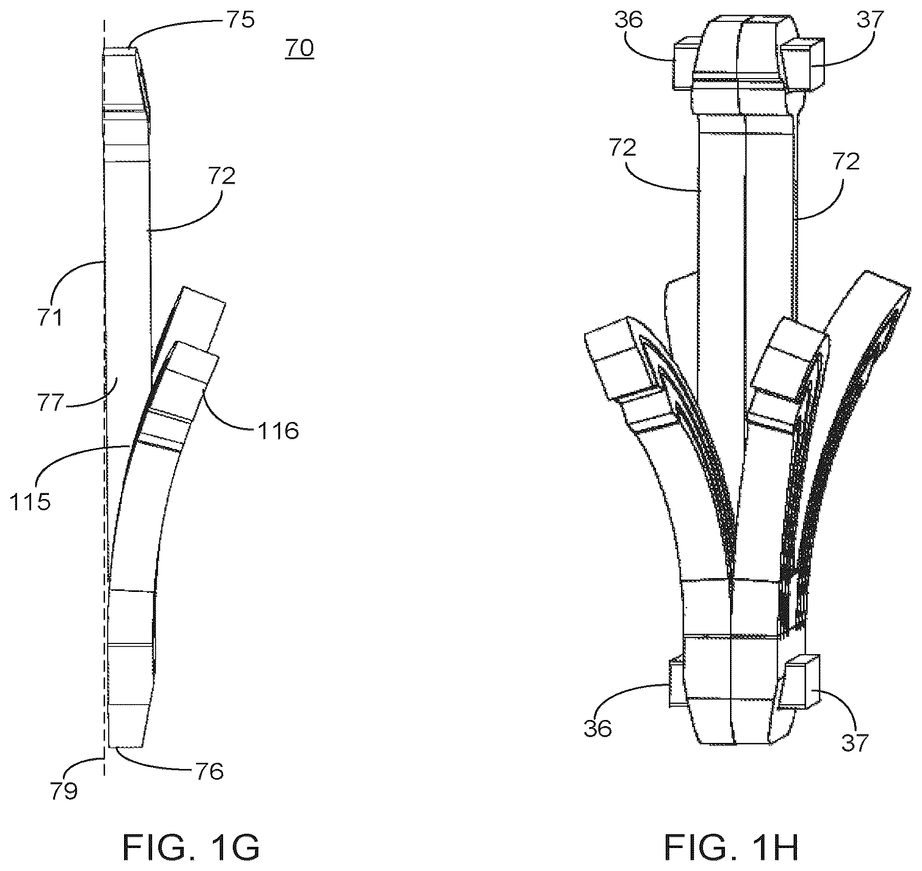Patent US12551351 Figure 4 – Implant