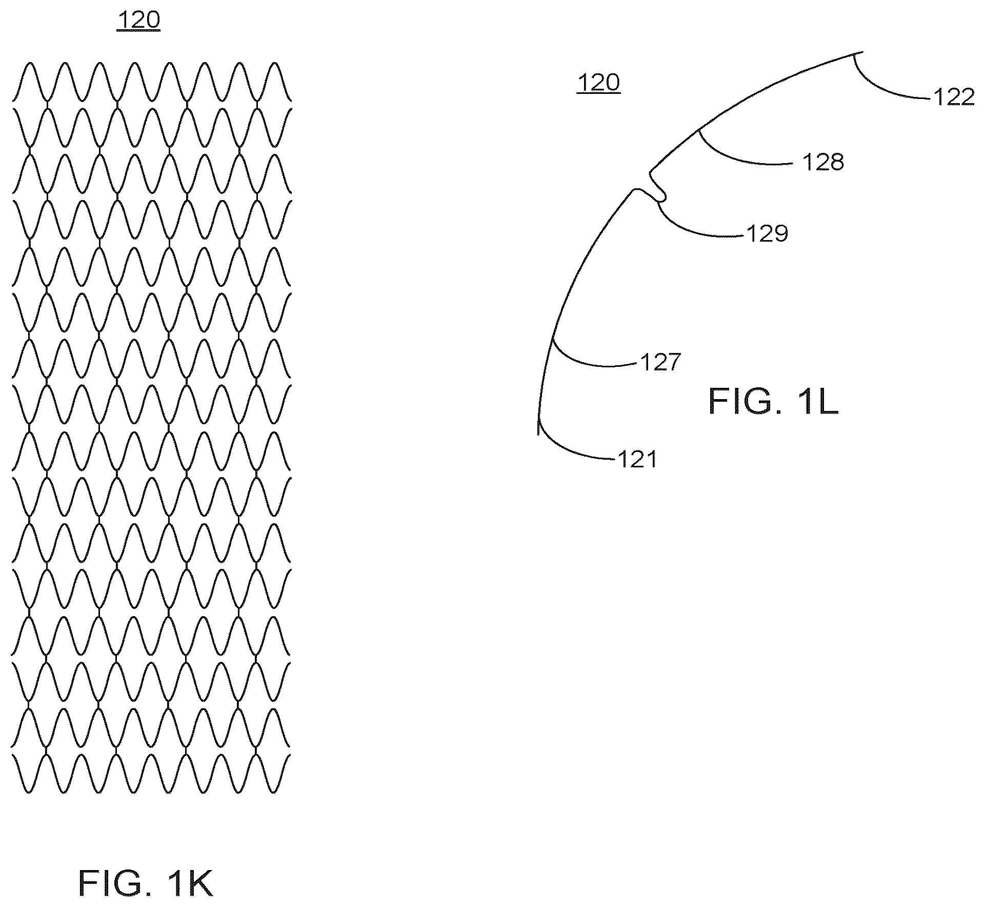 Patent US12551351 Figure 6 – Implant
