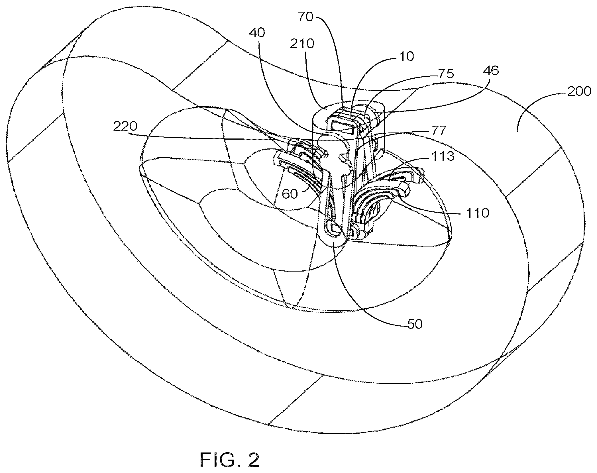 Patent US12551351 Figure 8 – Implant