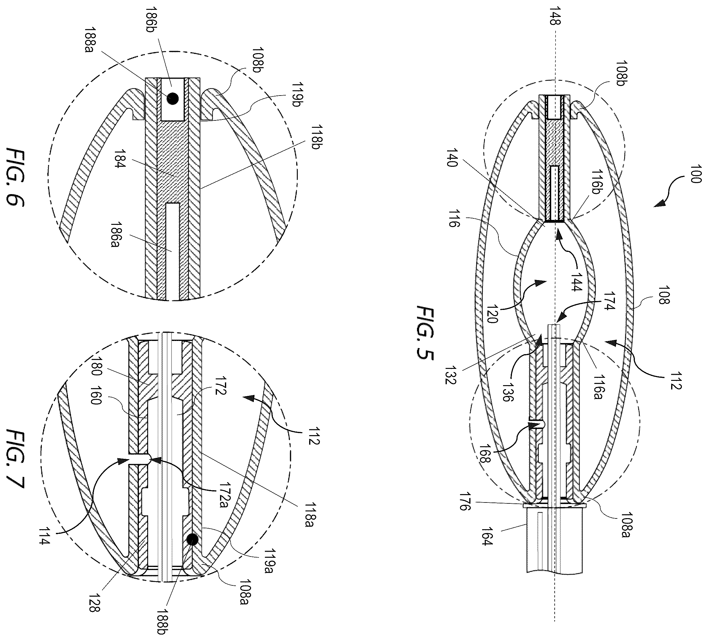 Patent US12551352 Figure 2 – Implantable nuclear prosthesis, kits, and related methods