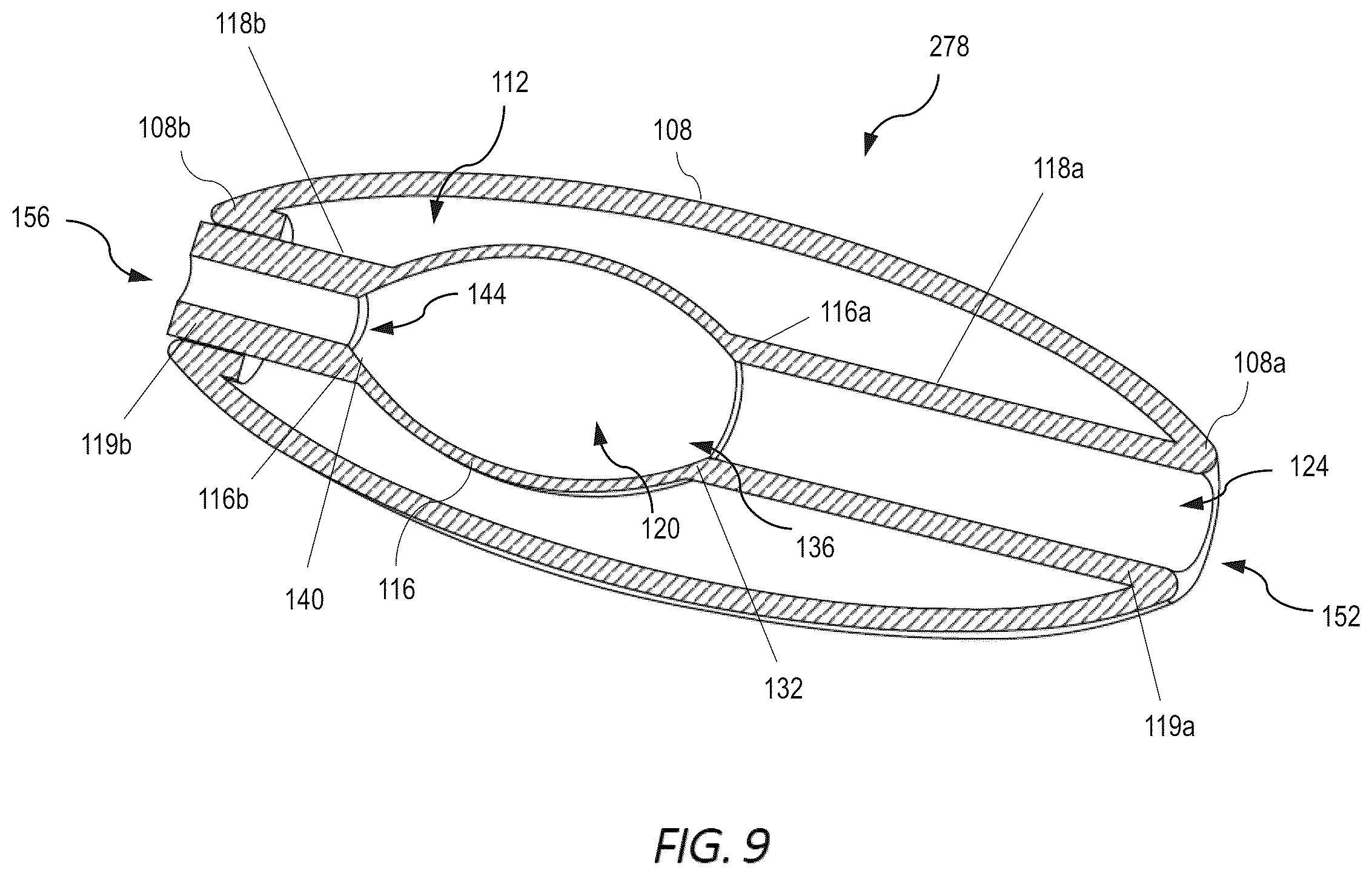 Patent US12551352 Figure 4 – Implantable nuclear prosthesis, kits, and related methods
