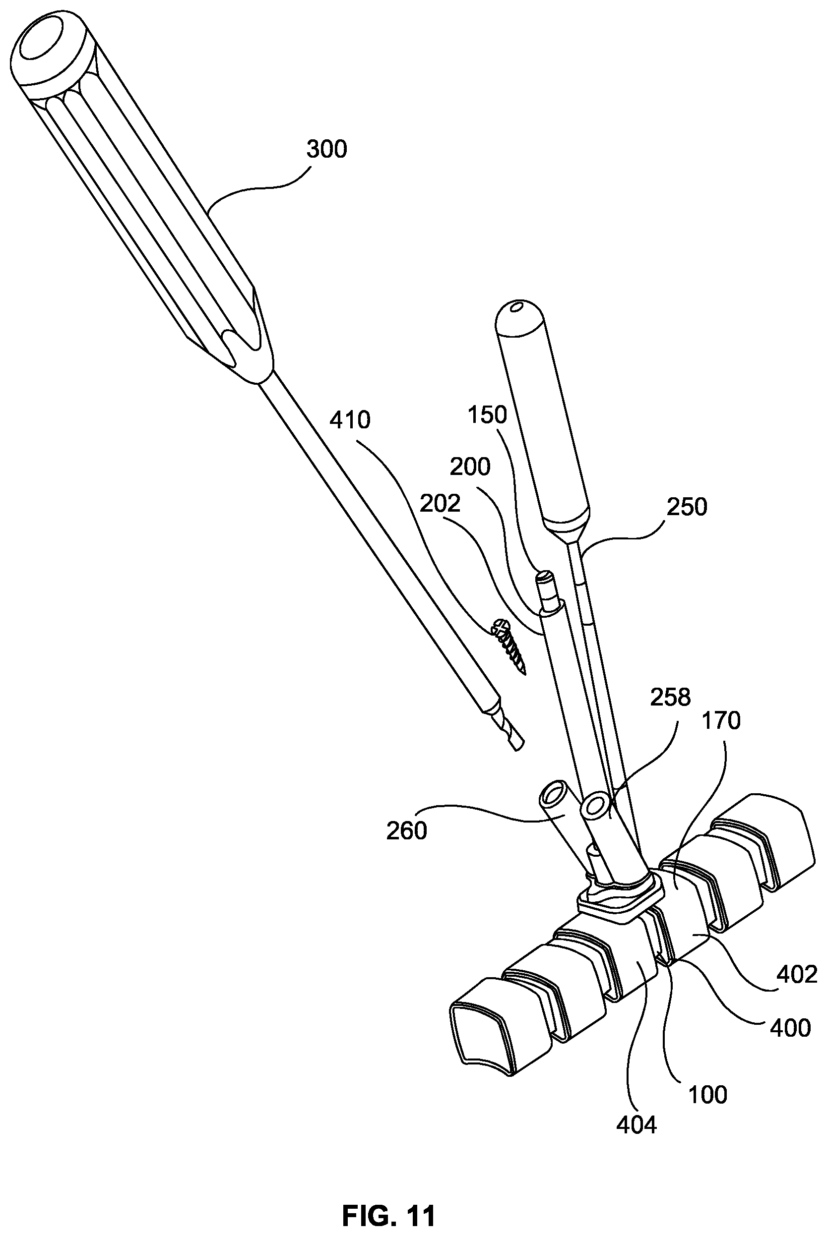 Patent US12551353 Figure 11 – Spinal plate selection and positioning system