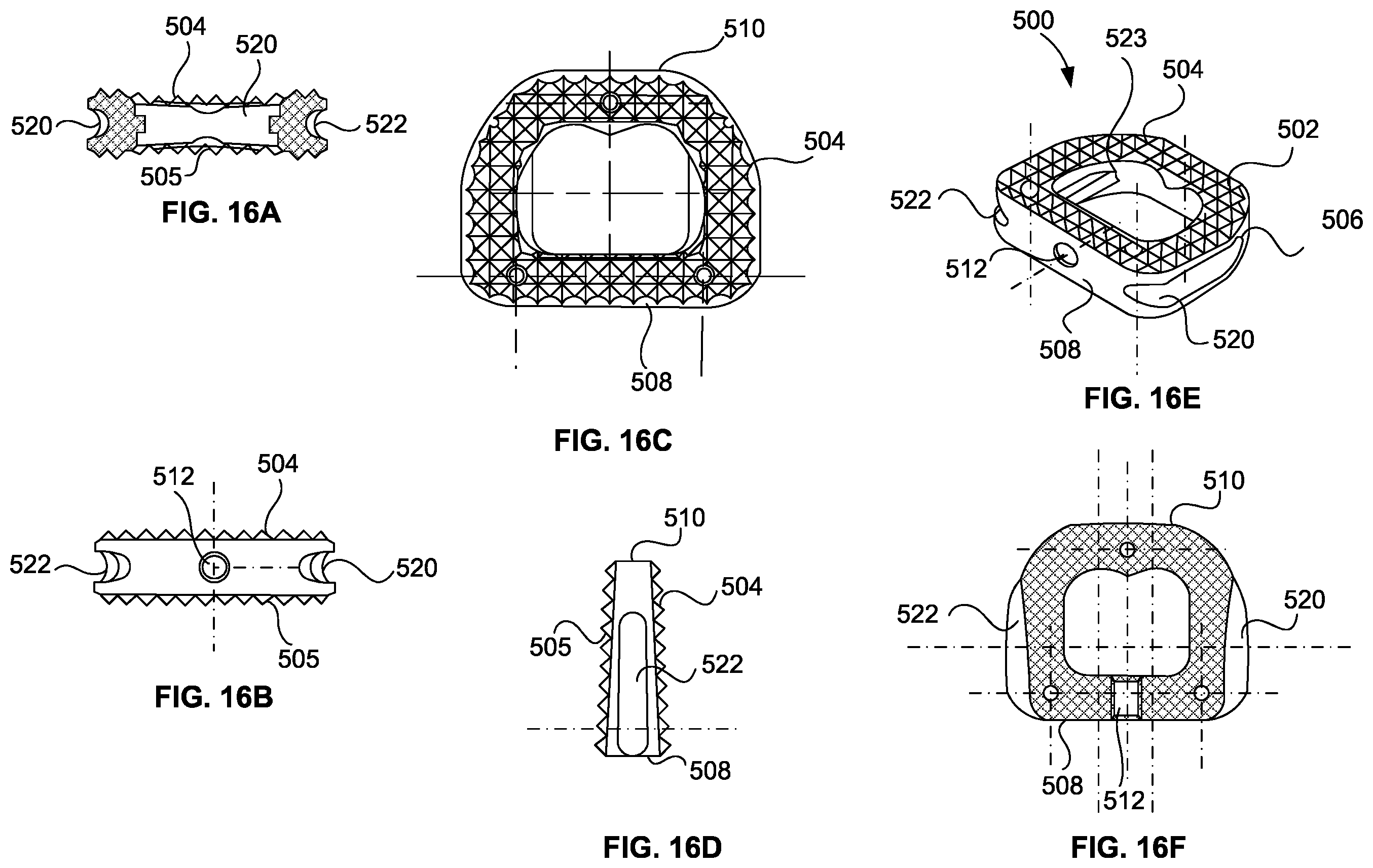 Patent US12551353 Figure 16 – Spinal plate selection and positioning system