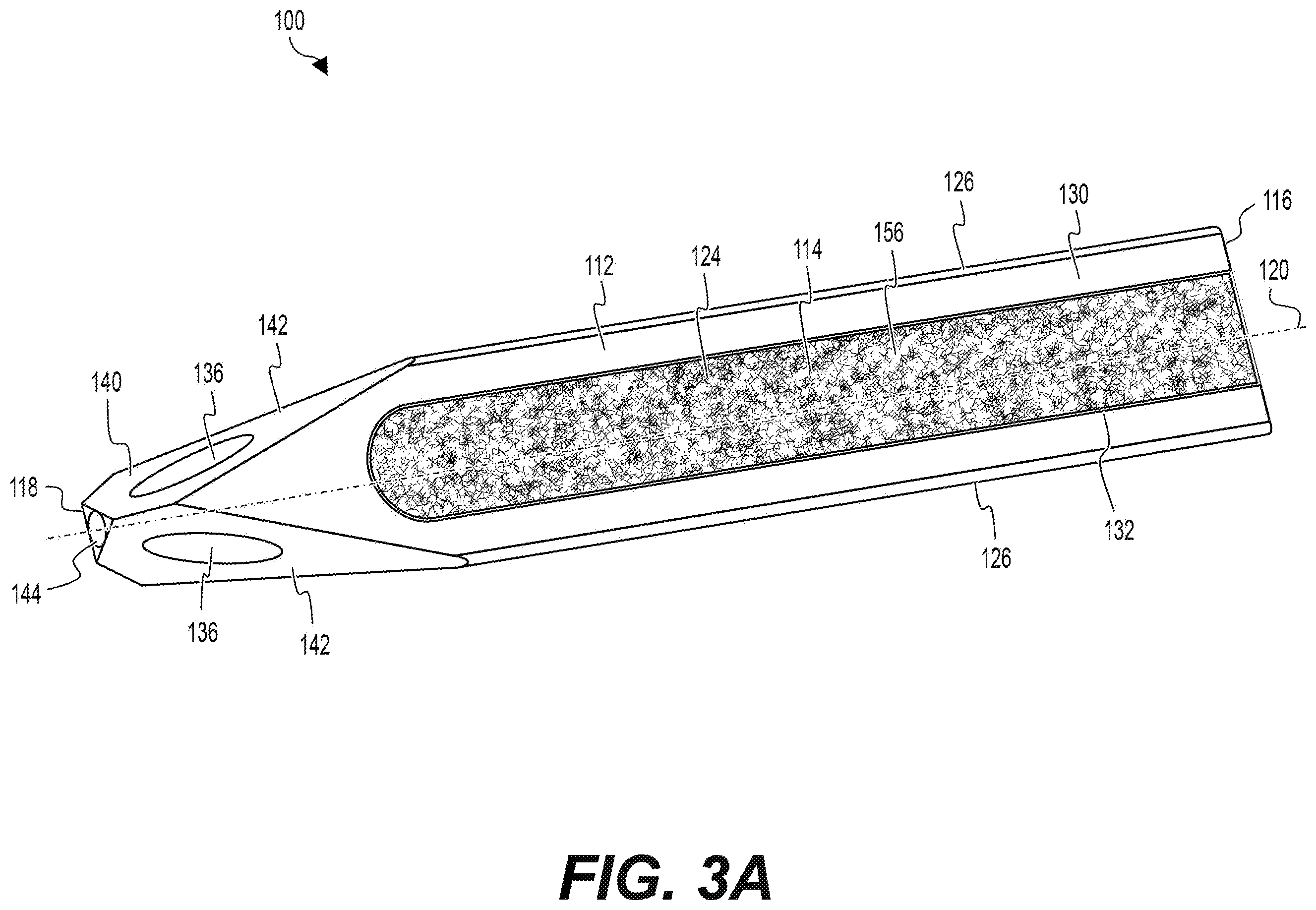 Patent US12551354 Figure 5 – Sacroiliac joint fusion implants