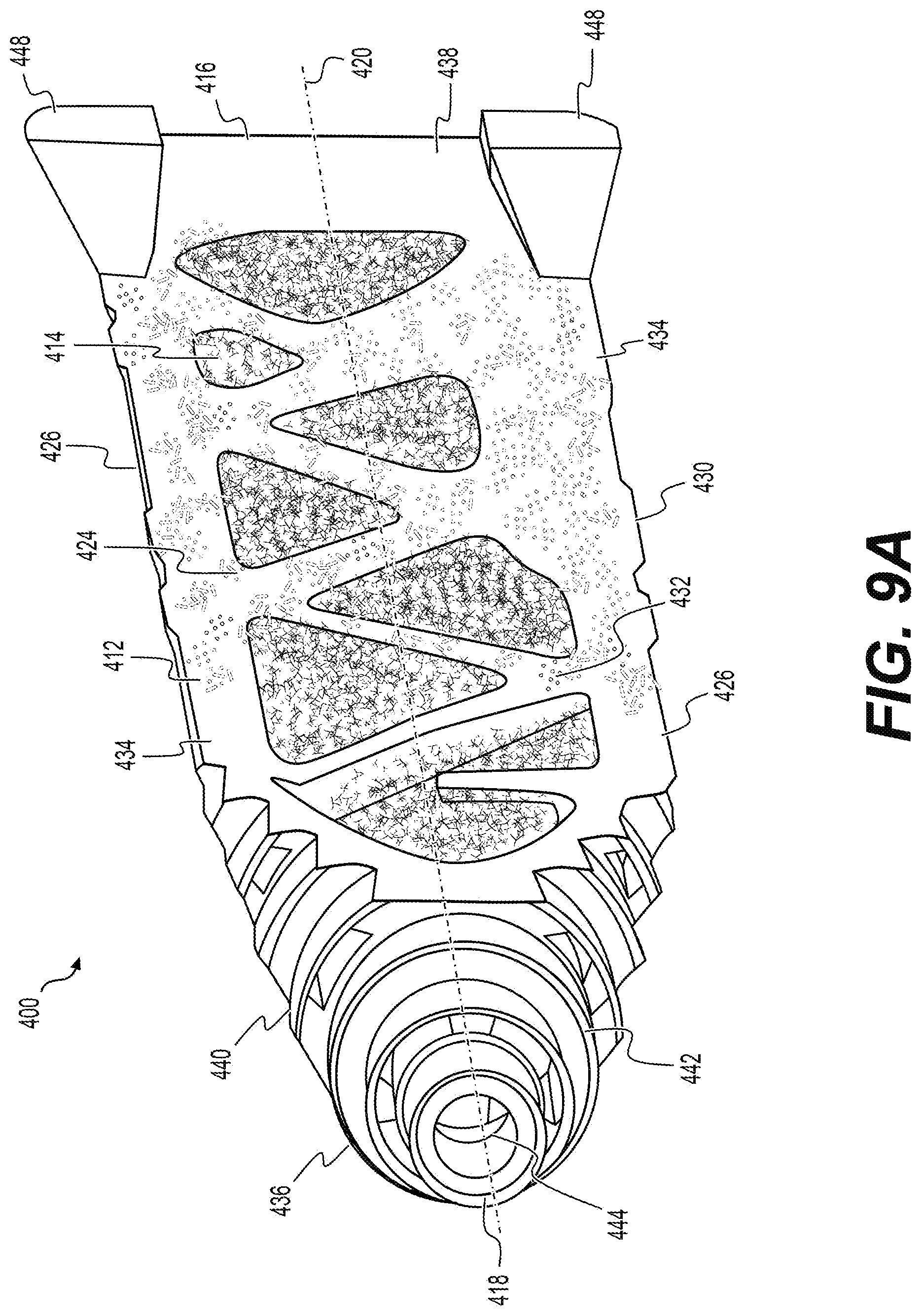 Patent US12551354 Figure 15 – Sacroiliac joint fusion implants