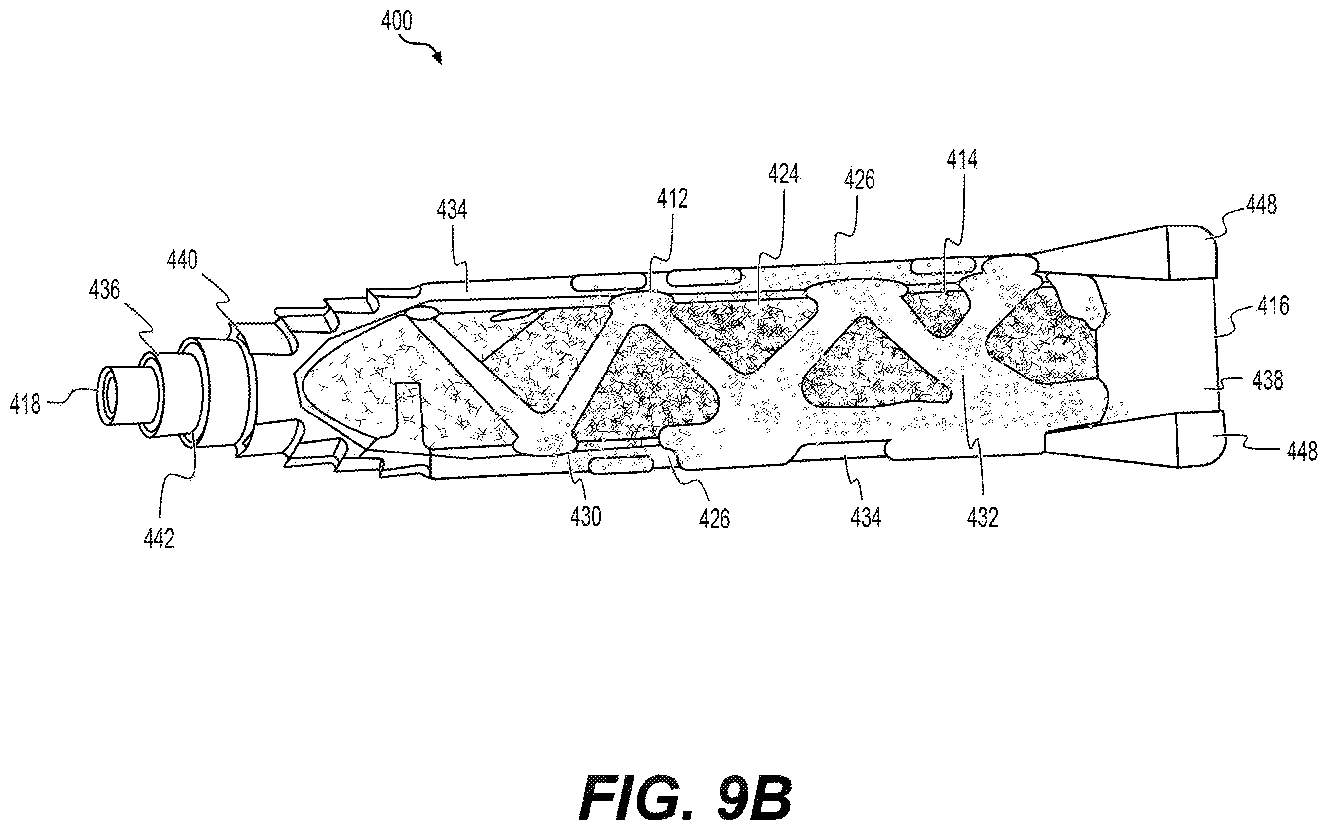 Patent US12551354 Figure 16 – Sacroiliac joint fusion implants