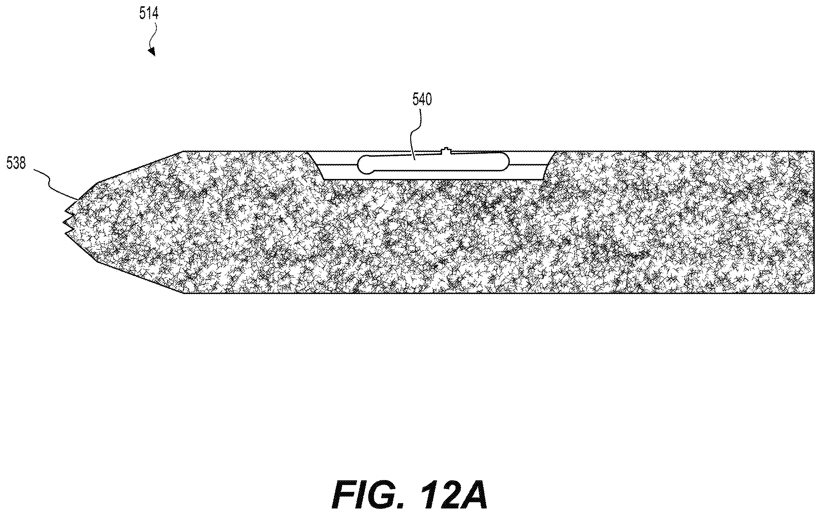 Patent US12551354 Figure 20 – Sacroiliac joint fusion implants