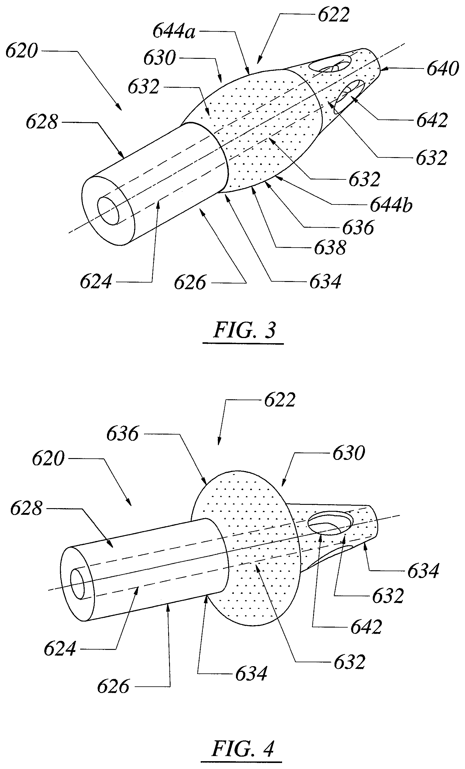 Patent US12551355 Figure 3 – Threadless spinal implant