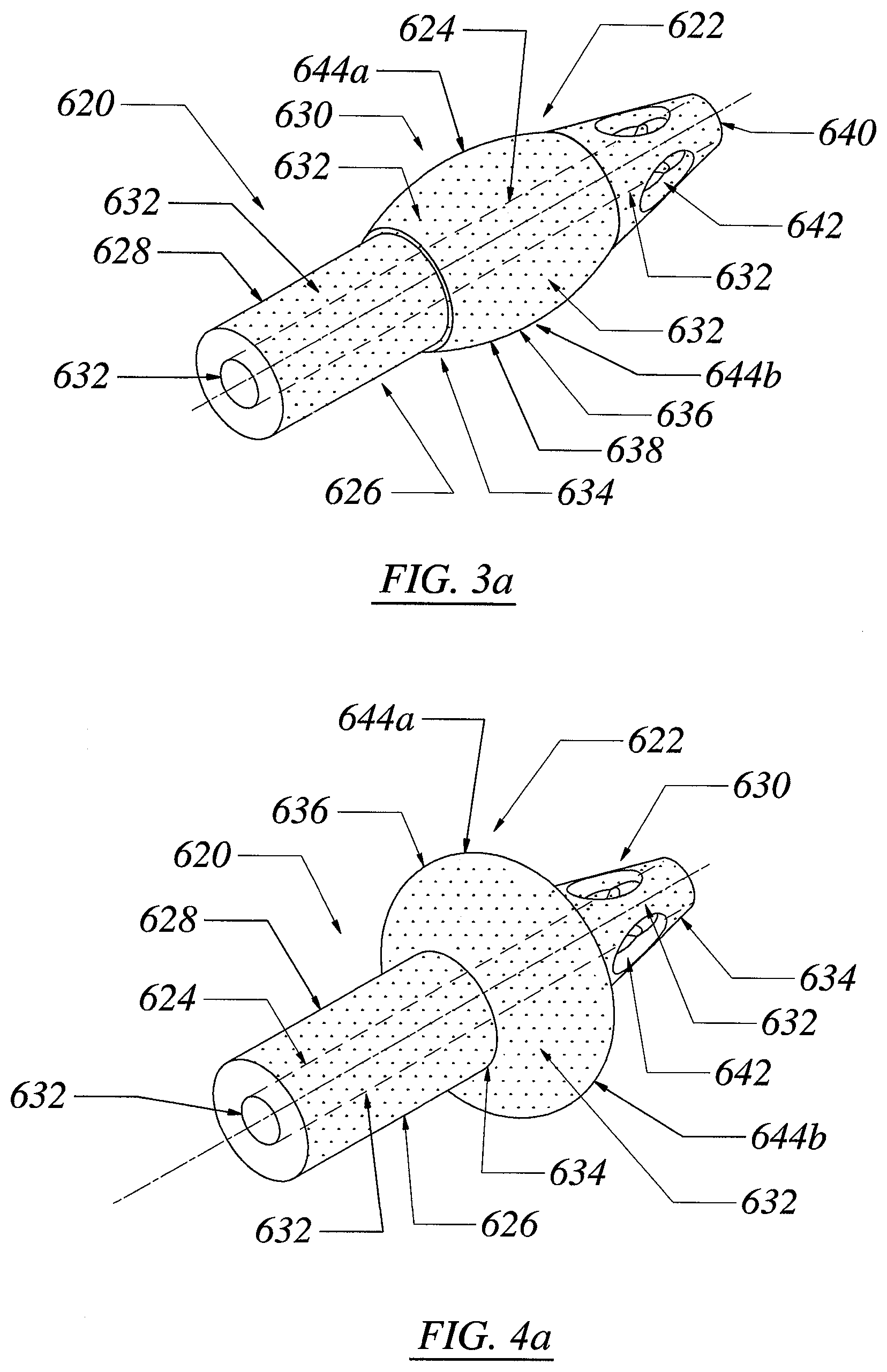 Patent US12551355 Figure 4 – Threadless spinal implant