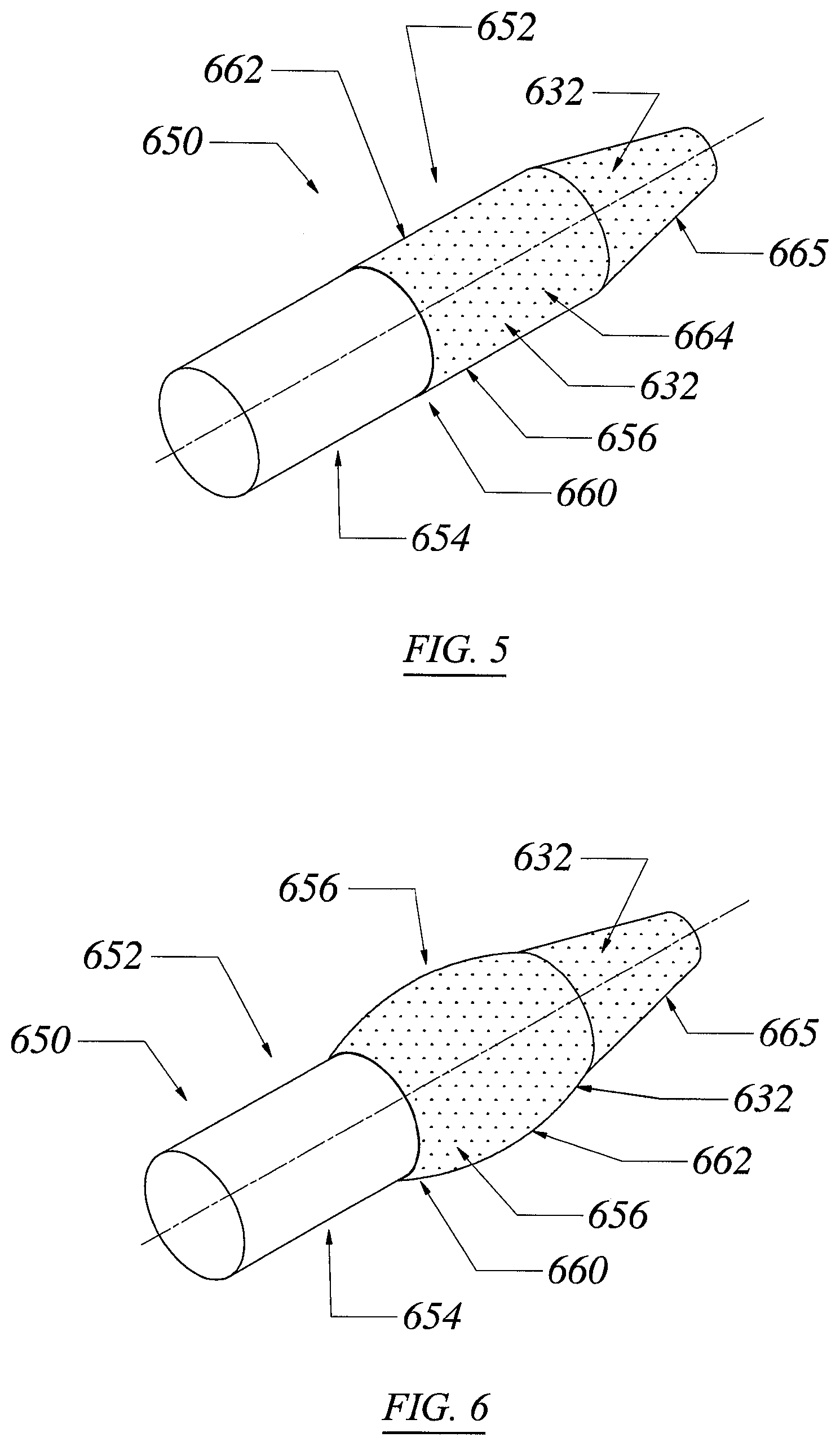 Patent US12551355 Figure 5 – Threadless spinal implant
