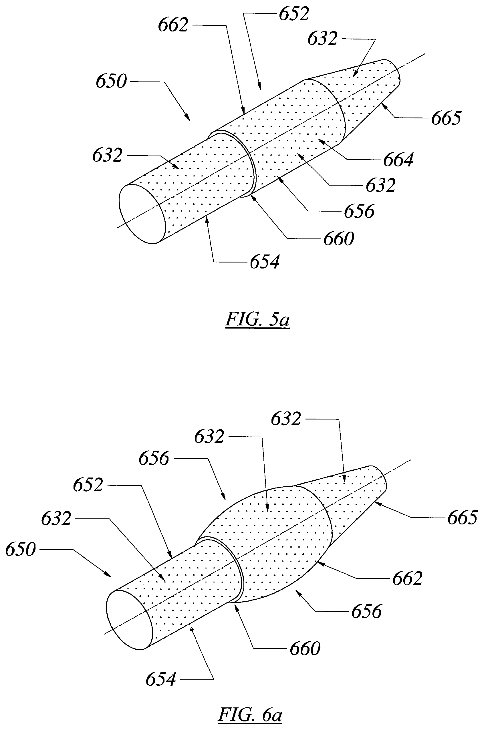 Patent US12551355 Figure 6 – Threadless spinal implant