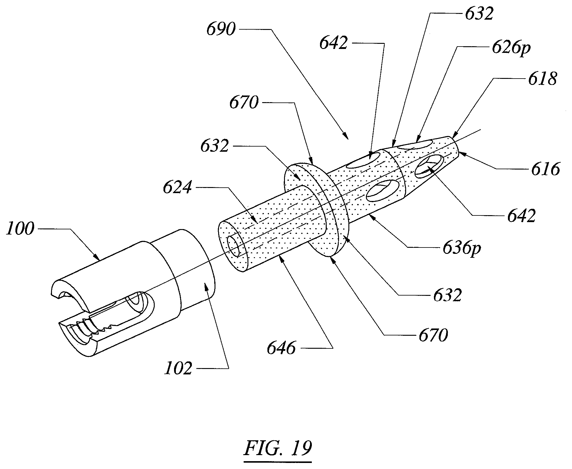 Patent US12551355 Figure 14 – Threadless spinal implant
