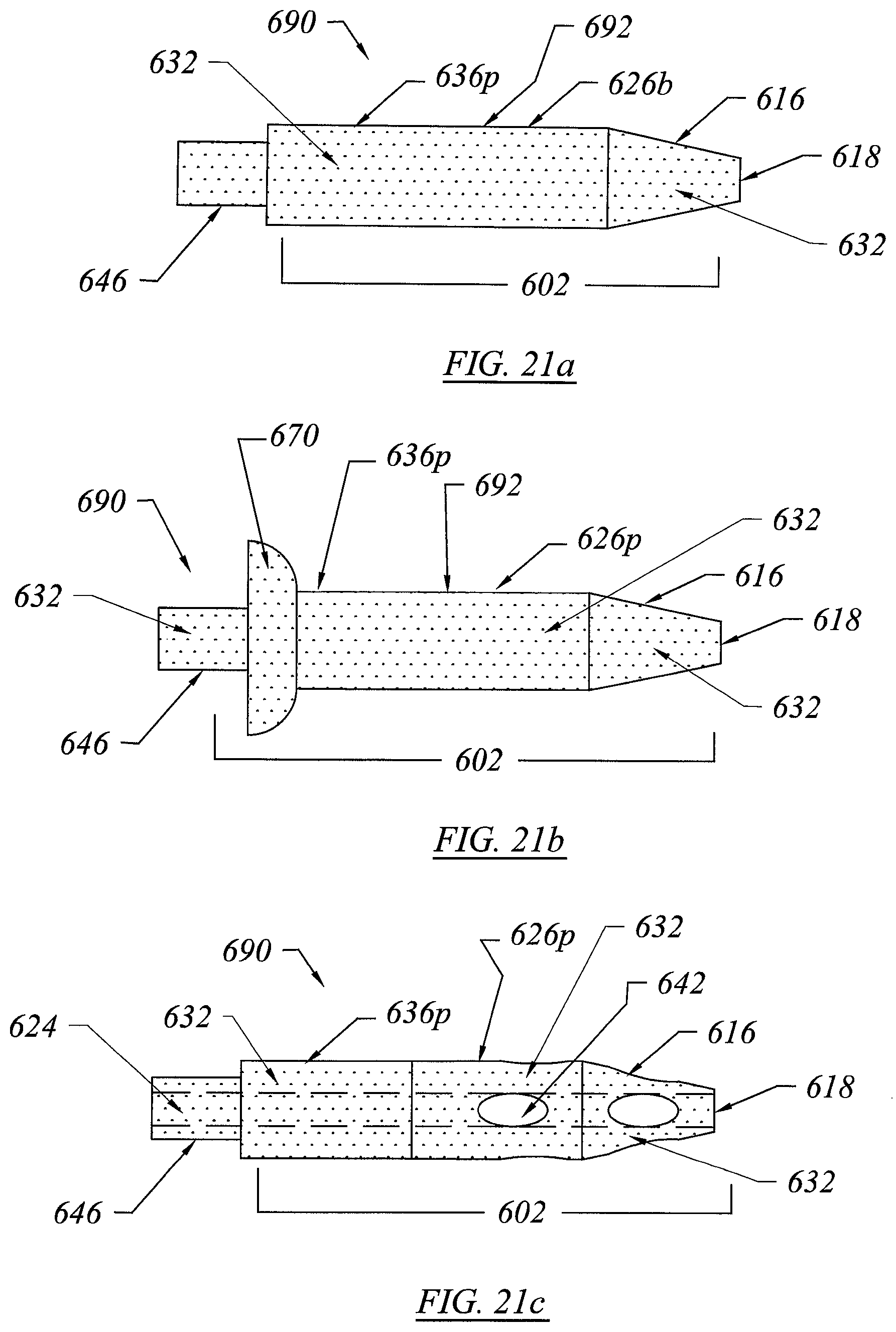 Patent US12551355 Figure 17 – Threadless spinal implant