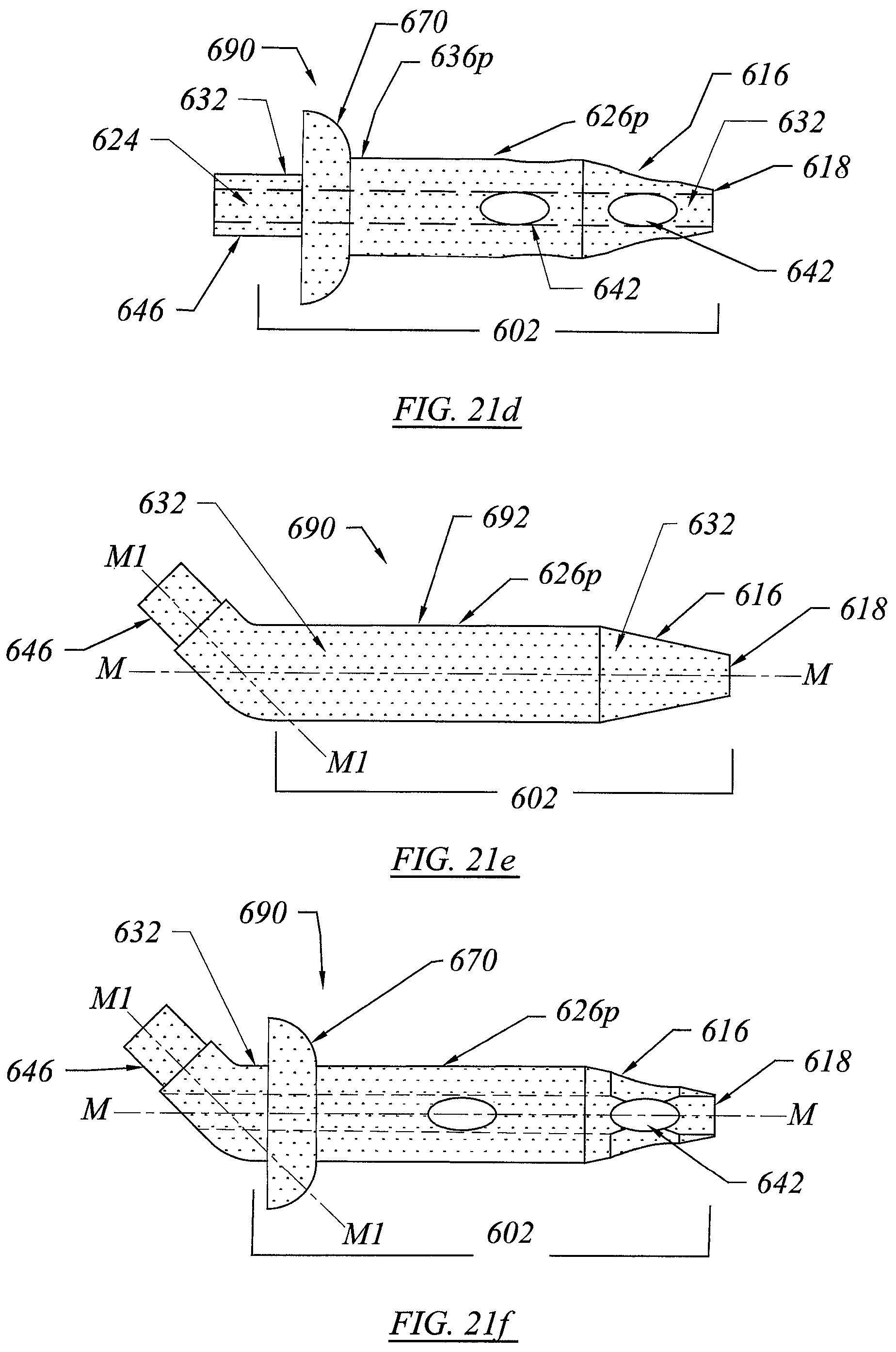 Patent US12551355 Figure 18 – Threadless spinal implant