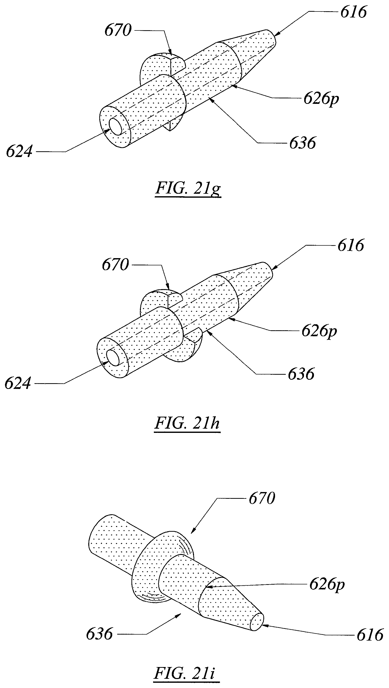 Patent US12551355 Figure 19 – Threadless spinal implant