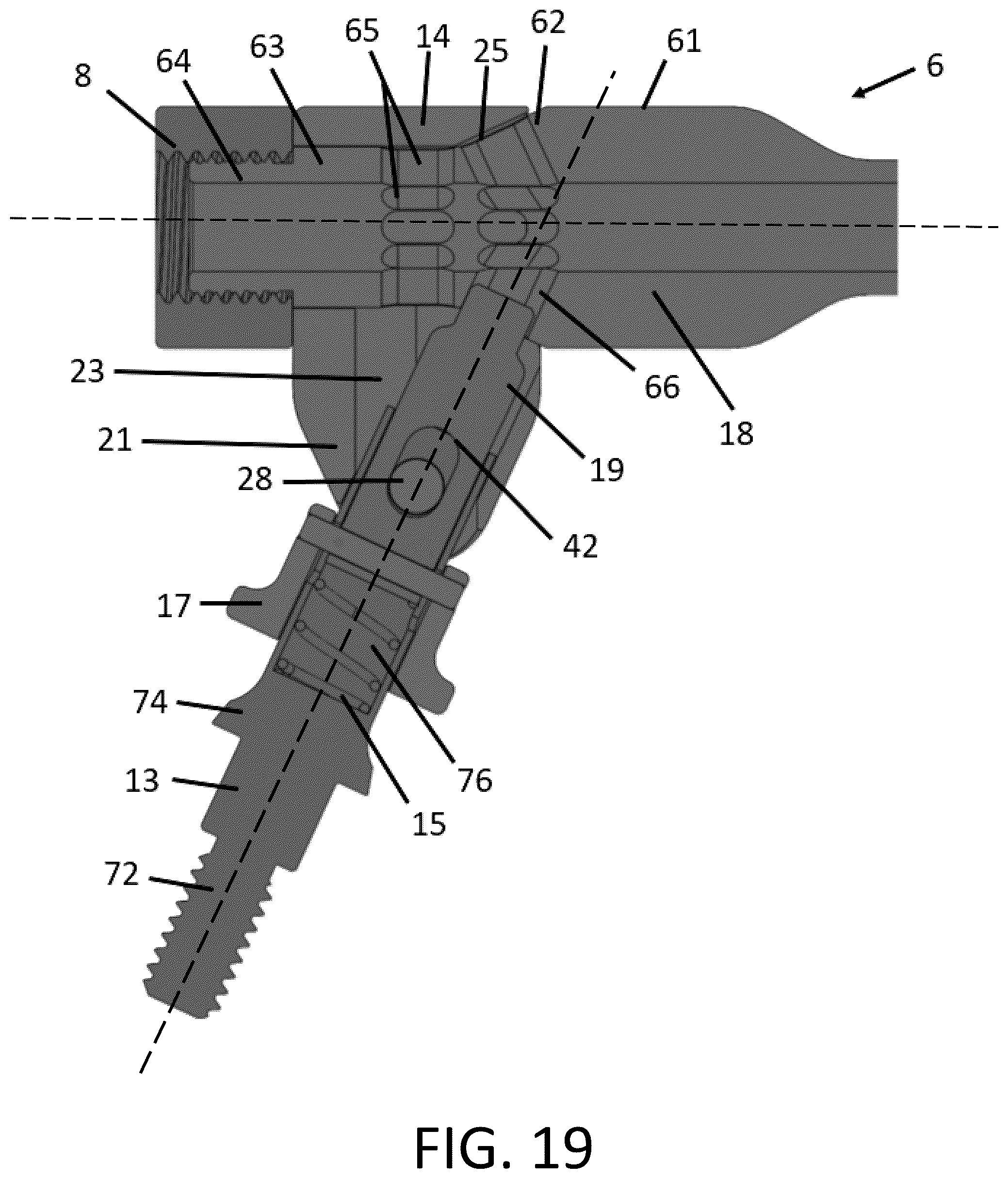 Patent US12551356 Figure 13 – Universal lateral pivoting handle
