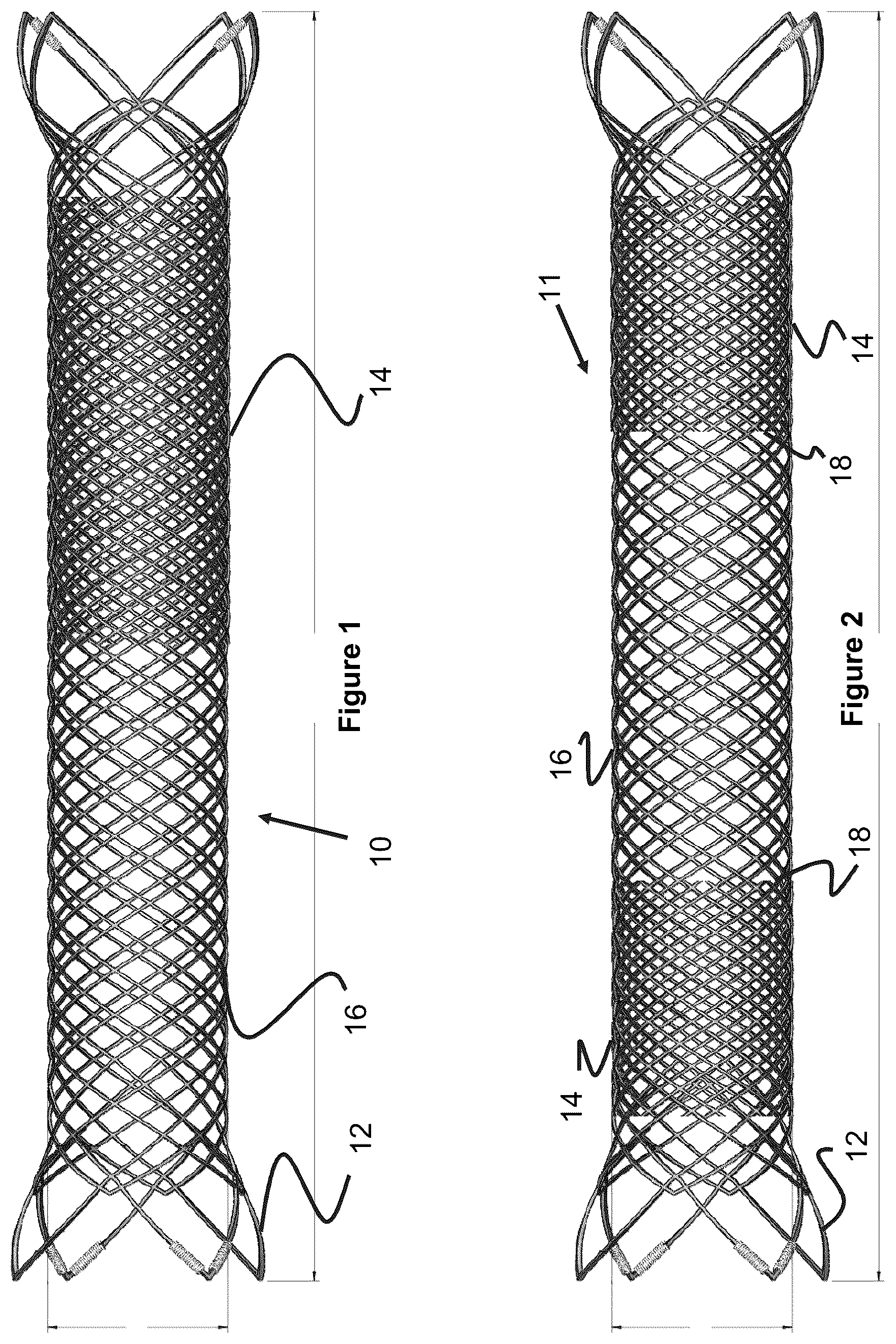 Patent US12551357 Figure 1 – Stent