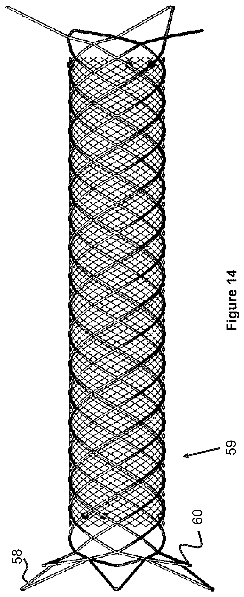 Patent US12551357 Figure 11 – Stent