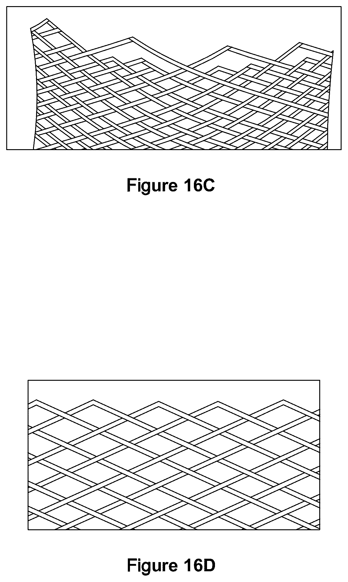 Patent US12551357 Figure 14 – Stent
