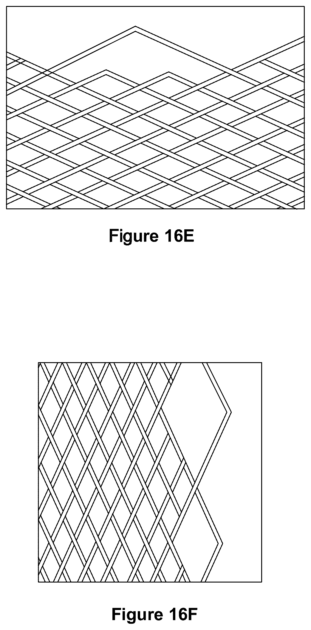 Patent US12551357 Figure 15 – Stent
